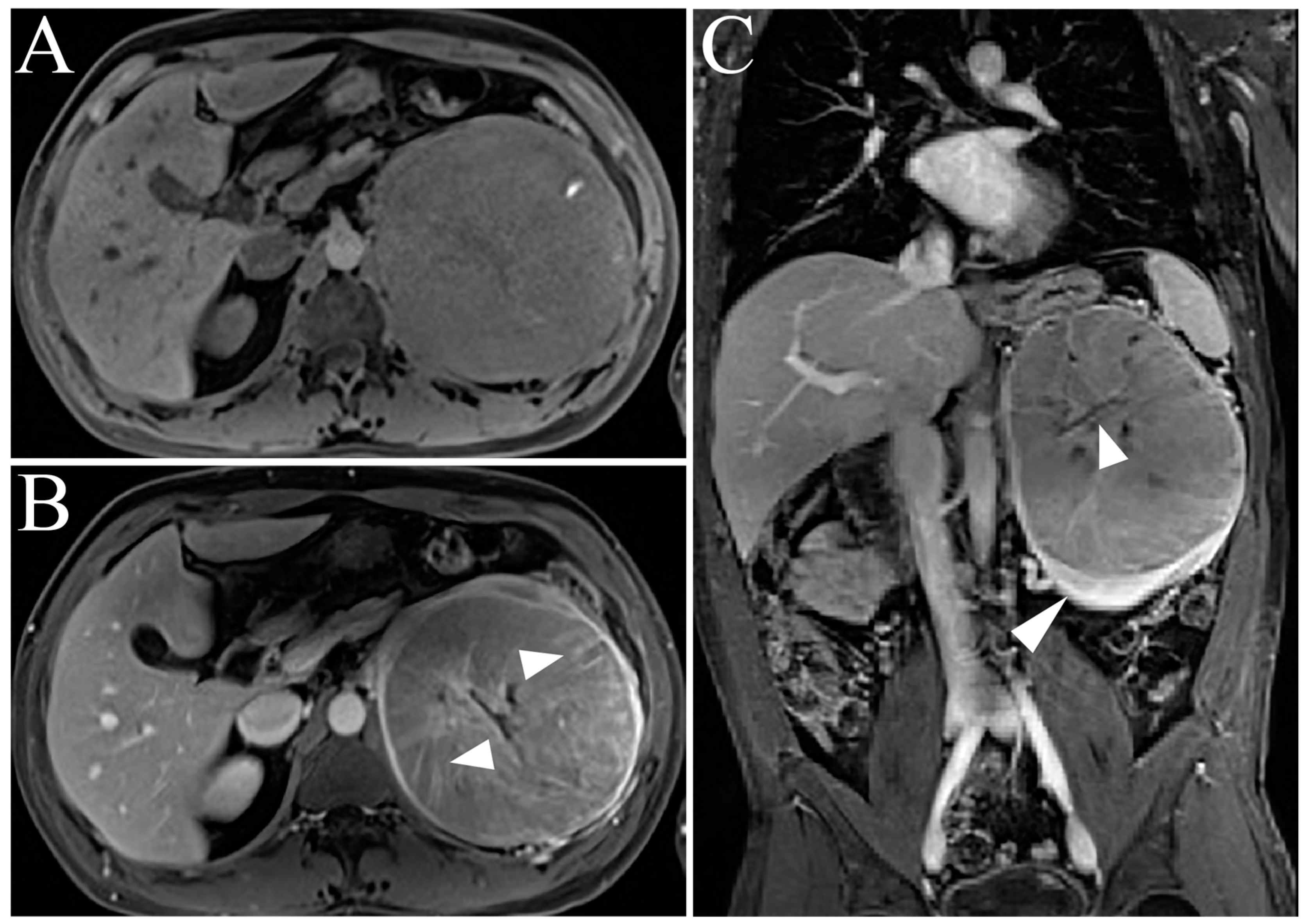 Cancers 15 02799 g006