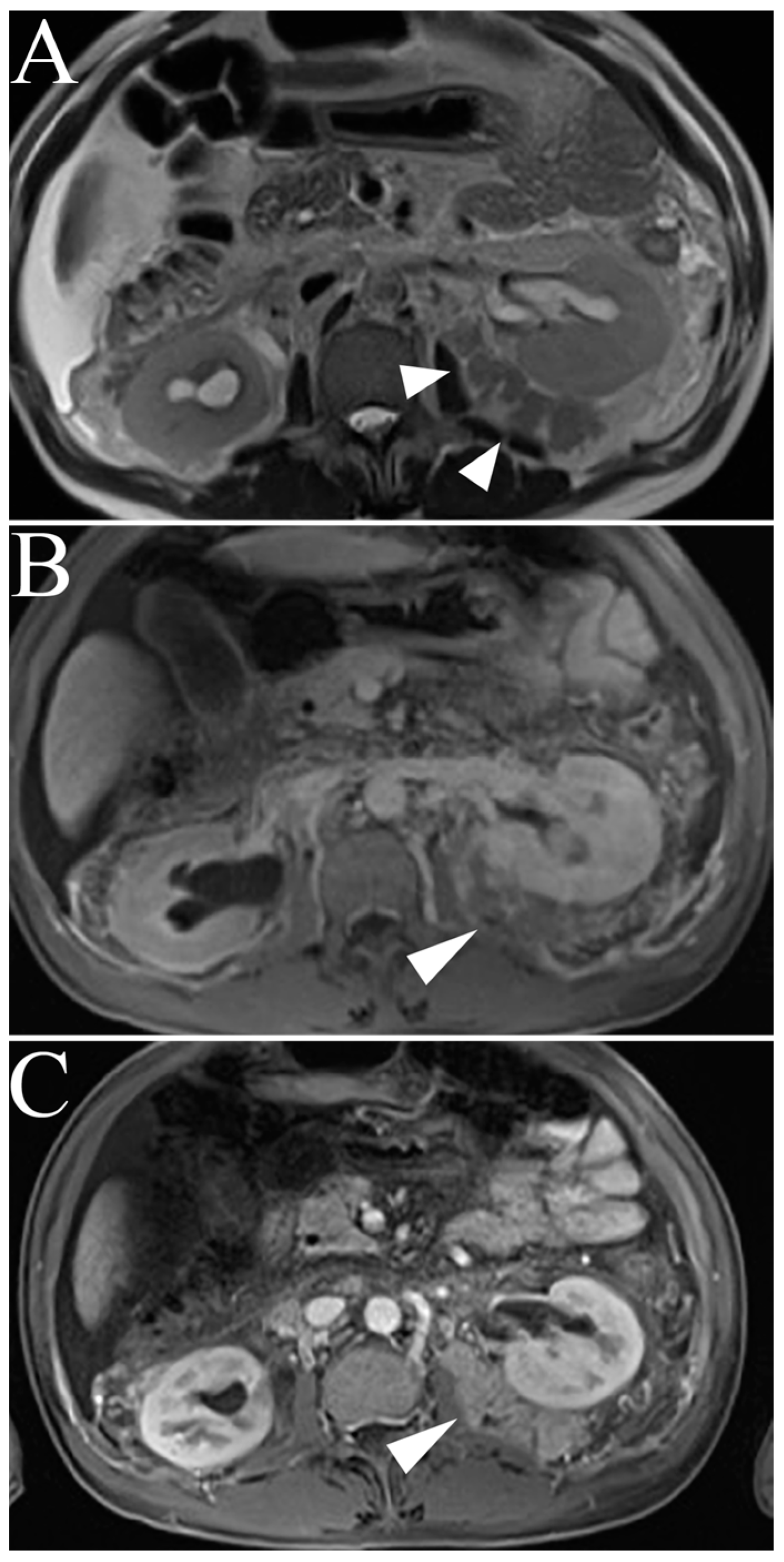 Cancers 15 02799 g007