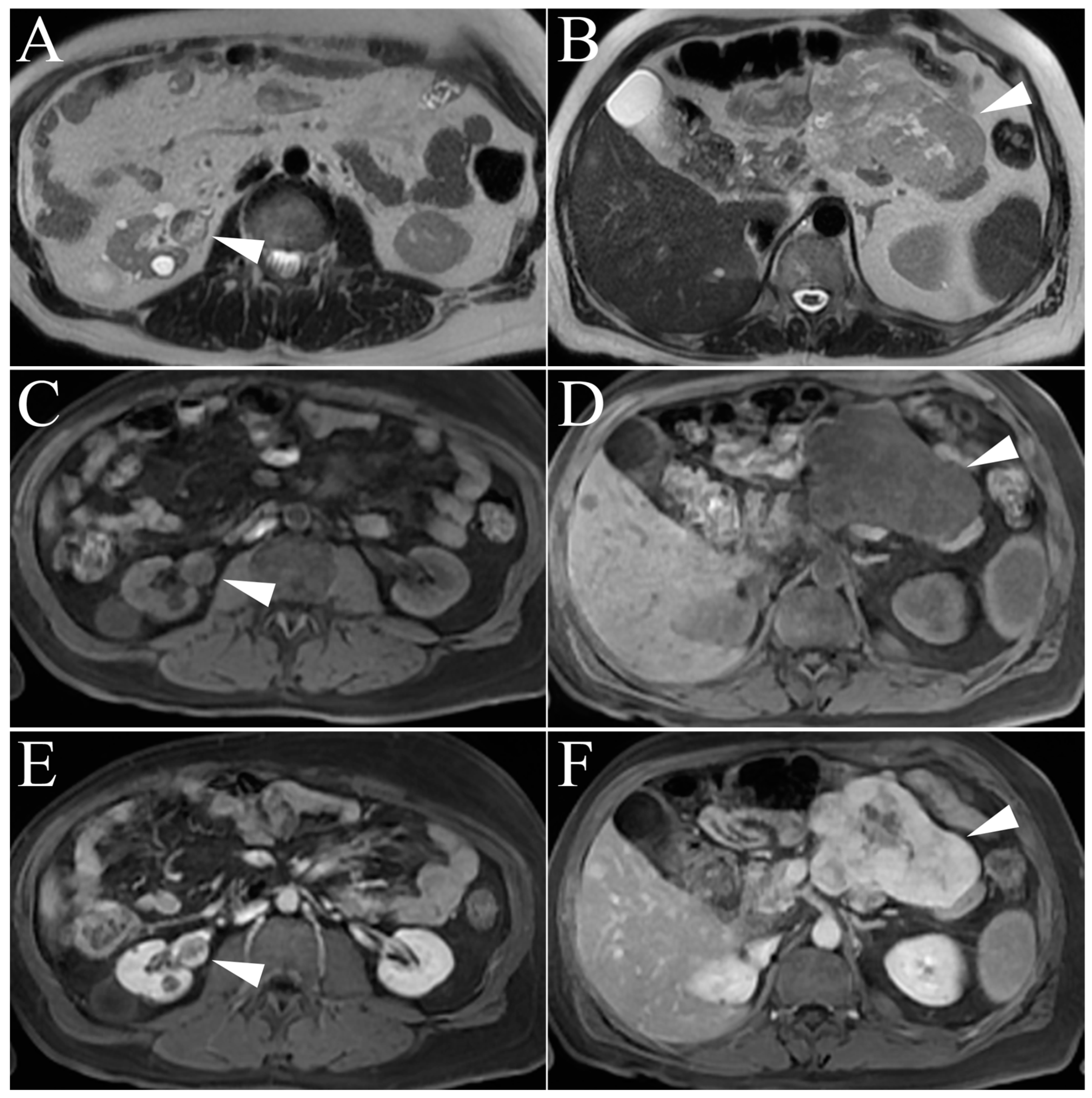 Cancers 15 02799 g008