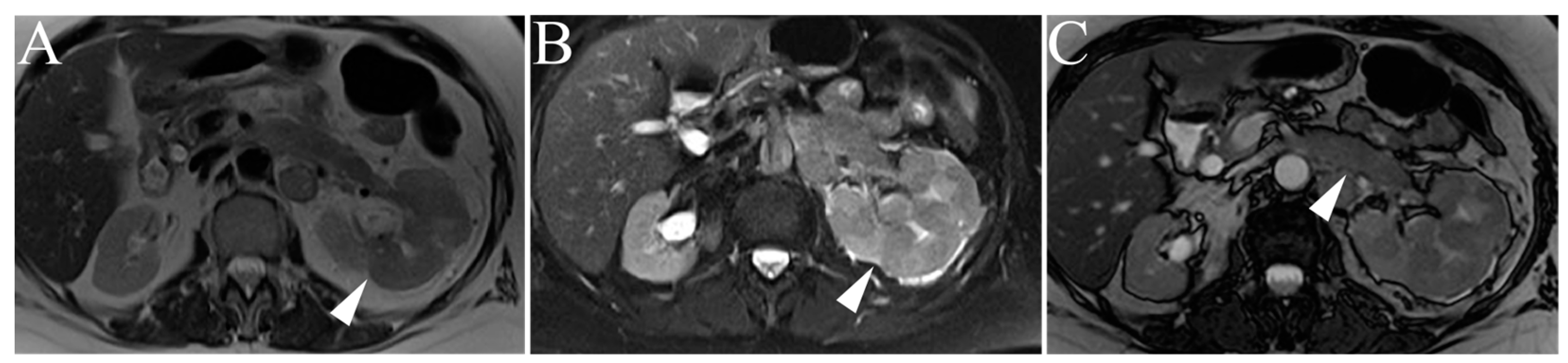 Cancers 15 02799 g009