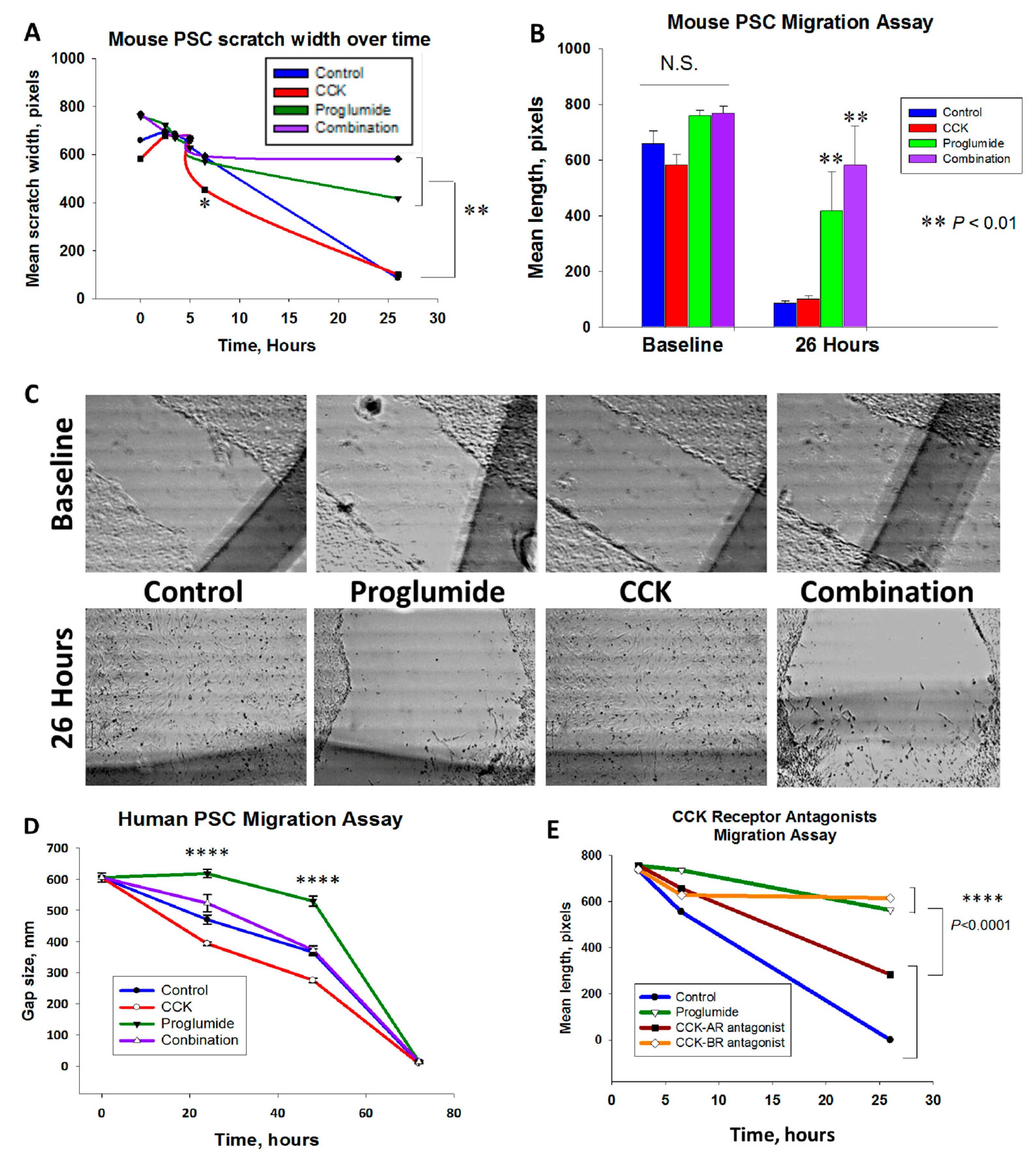 Cholecystokinin Receptor Antagonist Induces Pancreatic