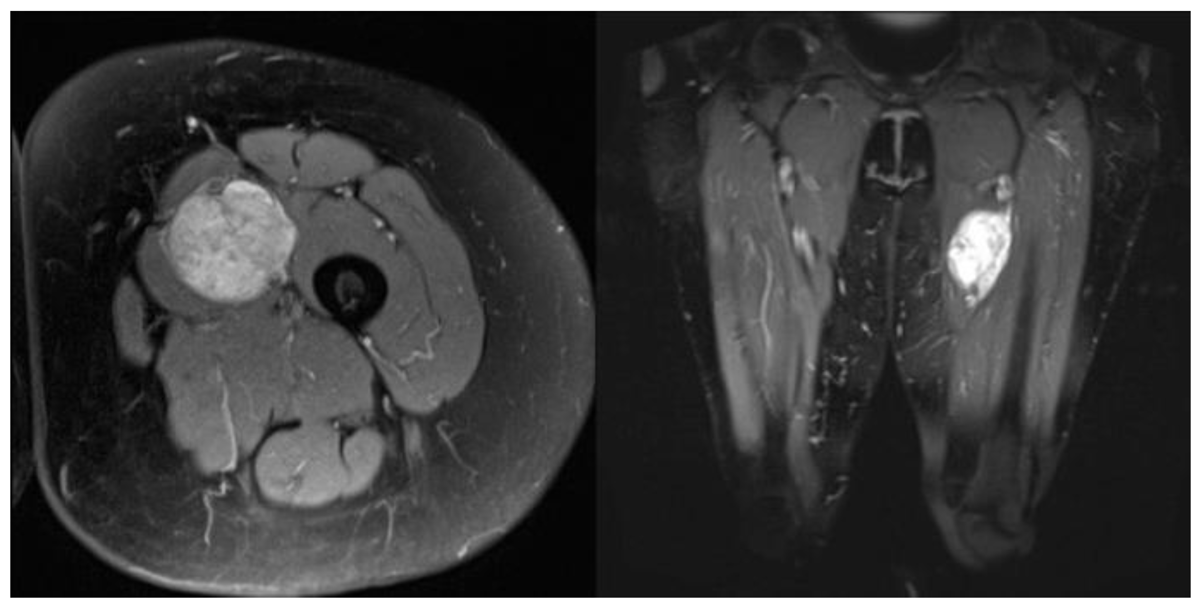 Cancers 15 02854 g002 Cancers 15 02854 g002