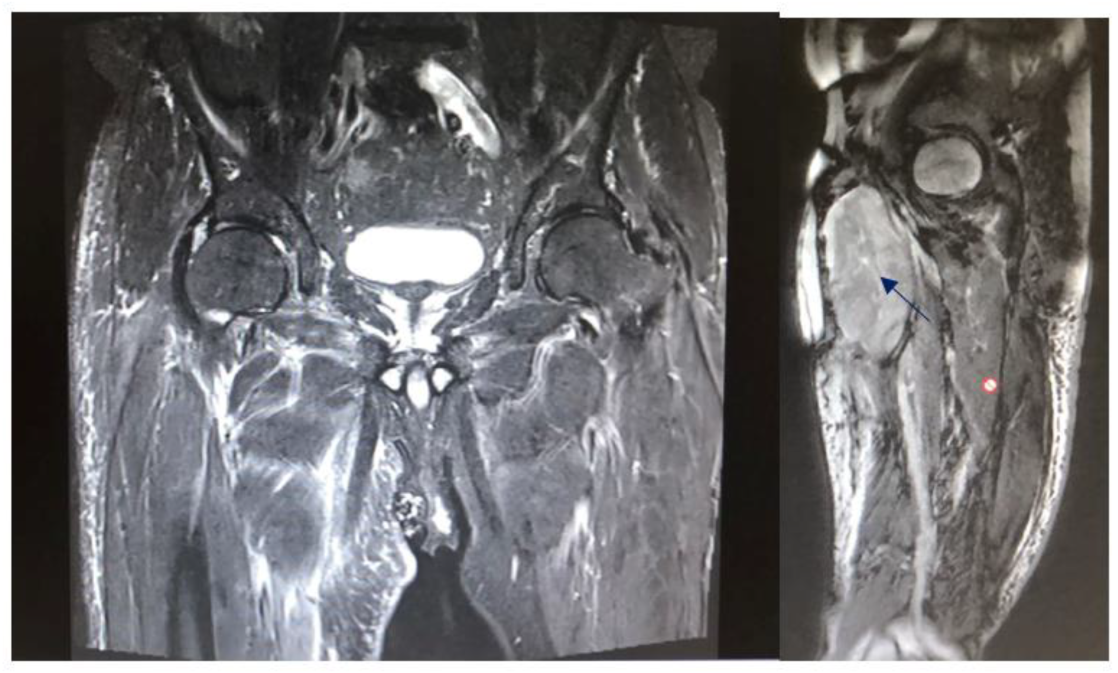 Cancers 15 02854 g003 Cancers 15 02854 g003