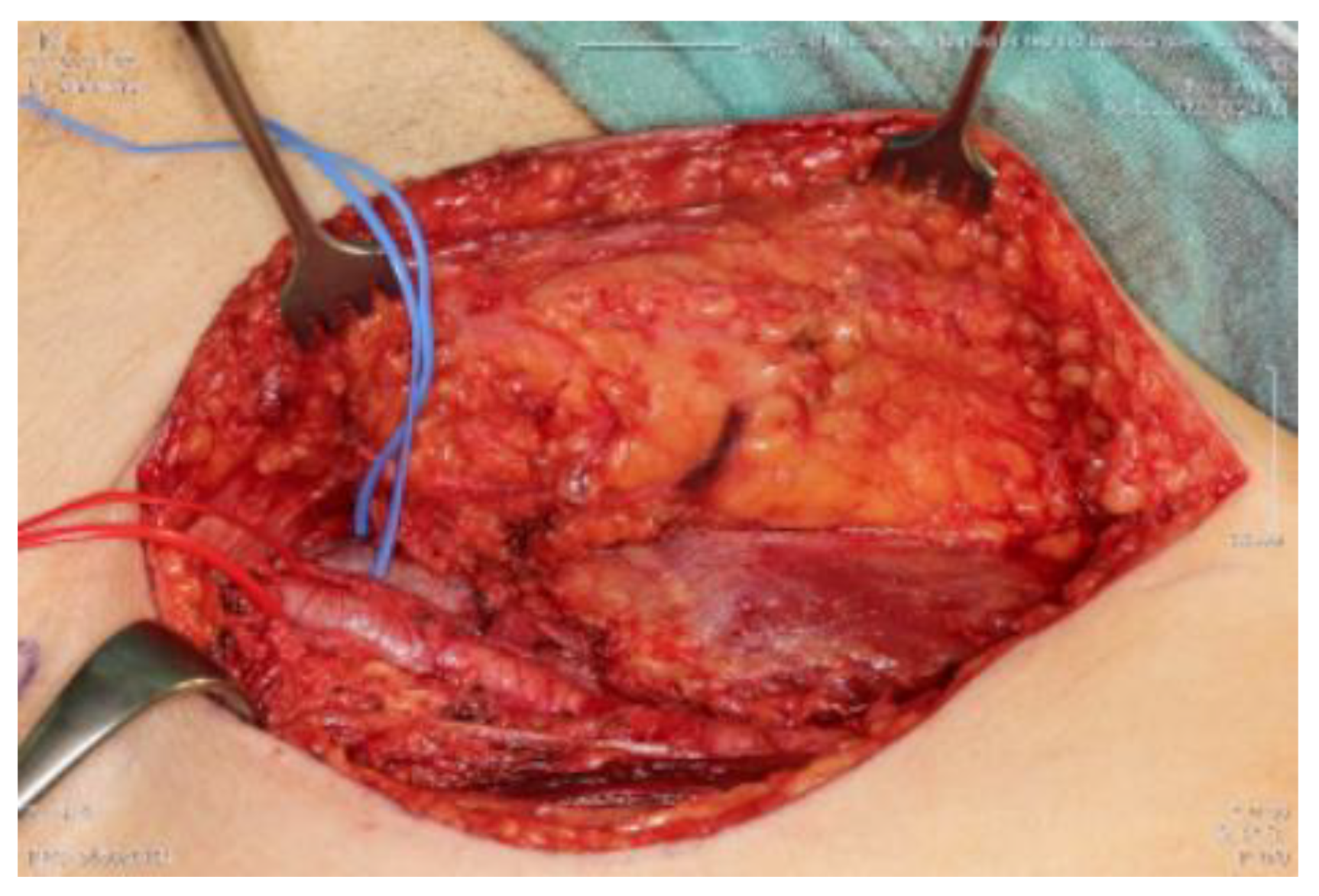 Cancers 15 02854 g006 Cancers 15 02854 g006