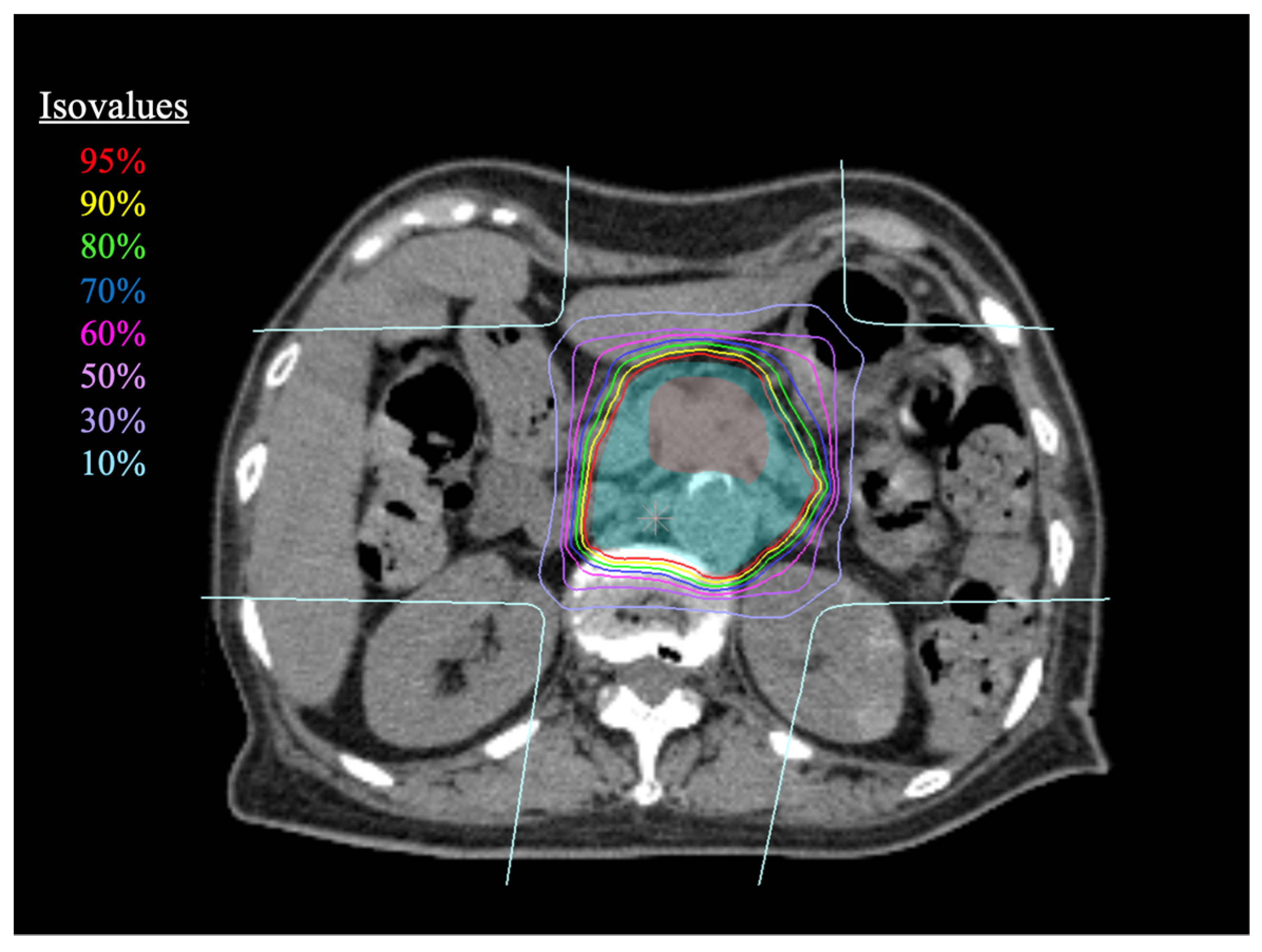 Cancers 15 02857 g001 Cancers 15 02857 g001