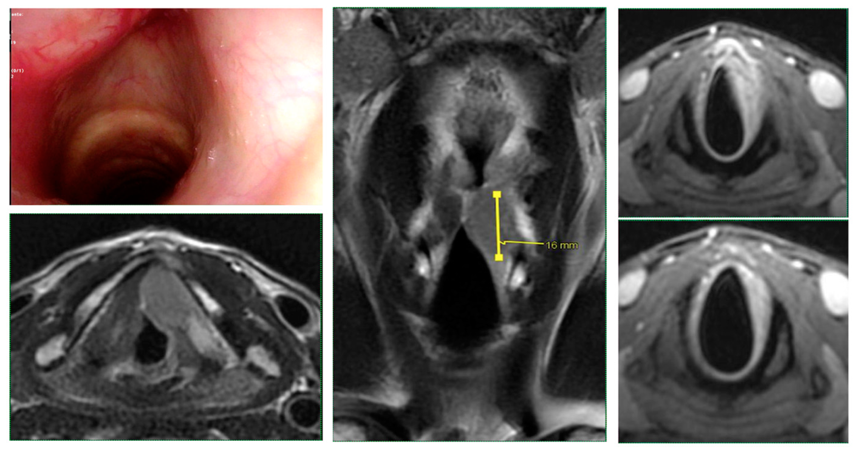 Cancers 15 02861 g001