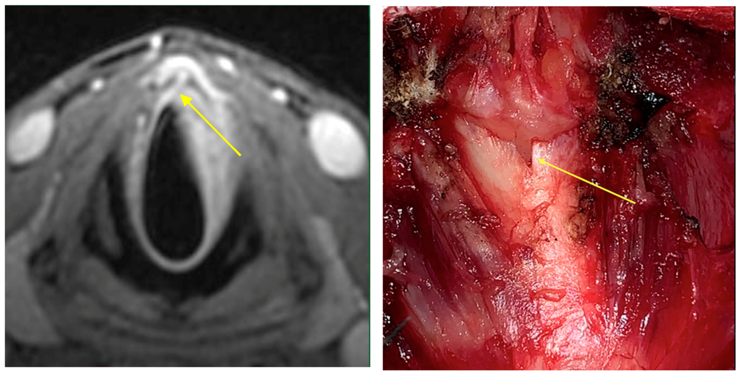 Cancers 15 02861 g002