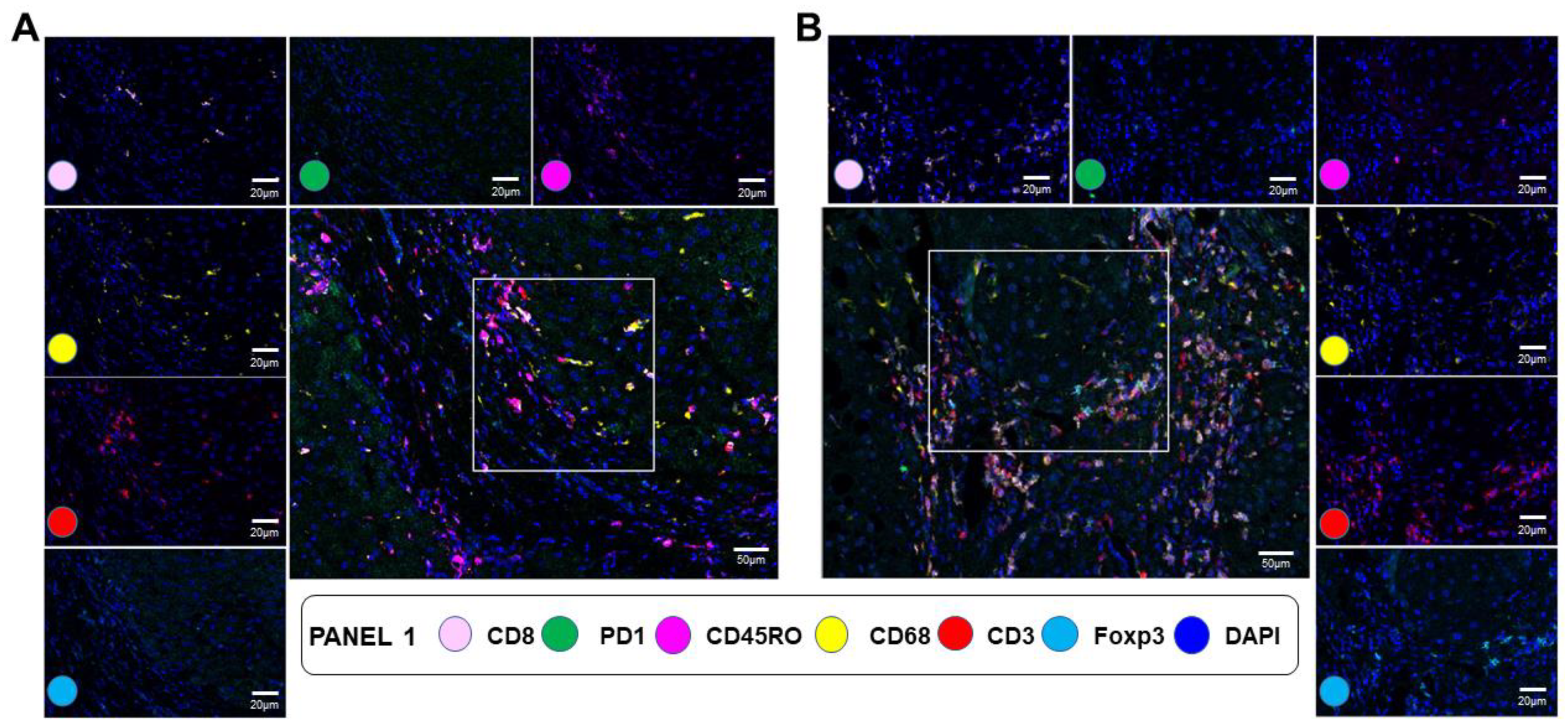 Cancers 15 02871 g005