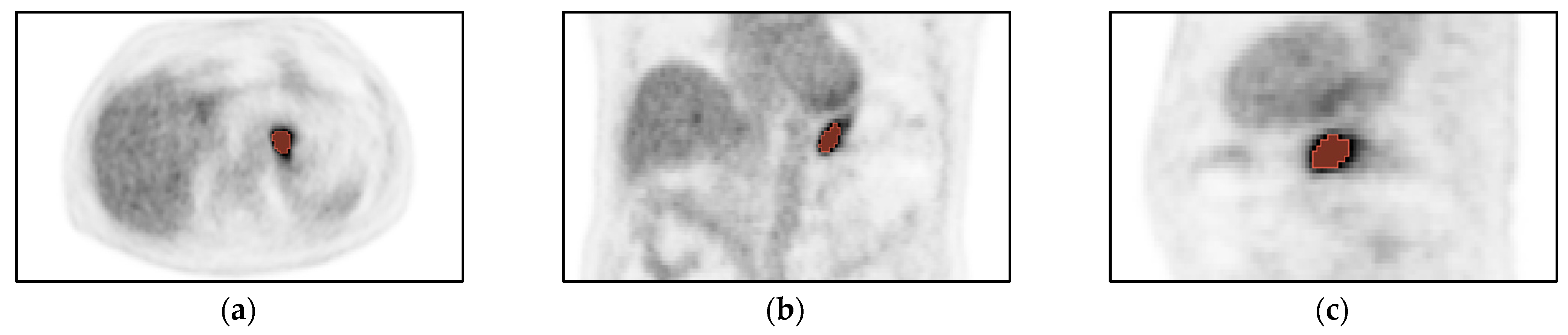 Cancers 15 02874 g002 Cancers 15 02874 g002