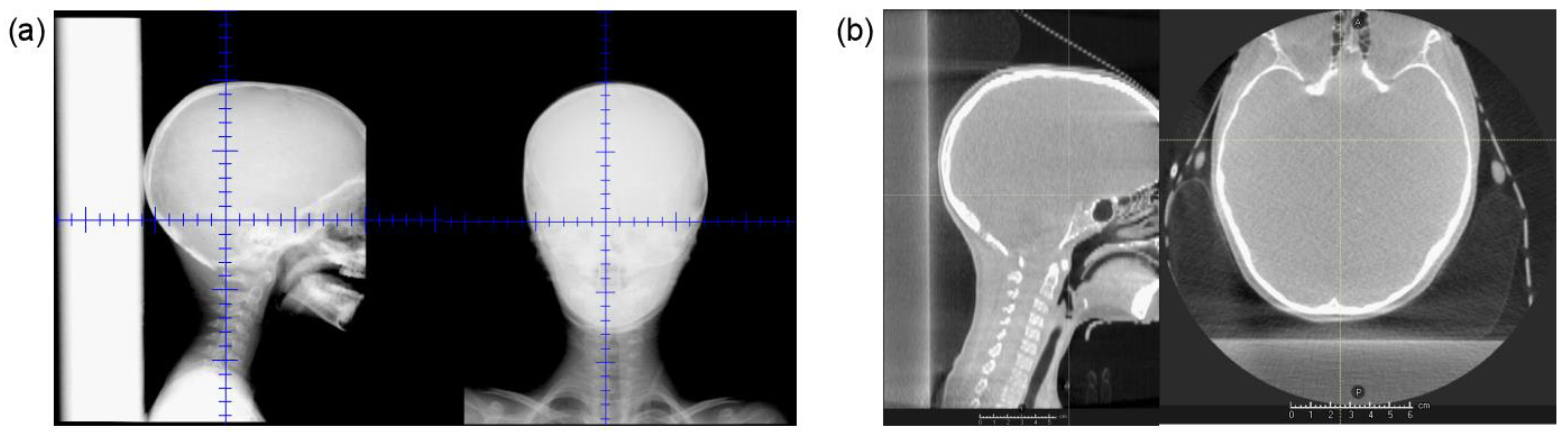 Cancers 15 02882 g006 Cancers 15 02882 g006