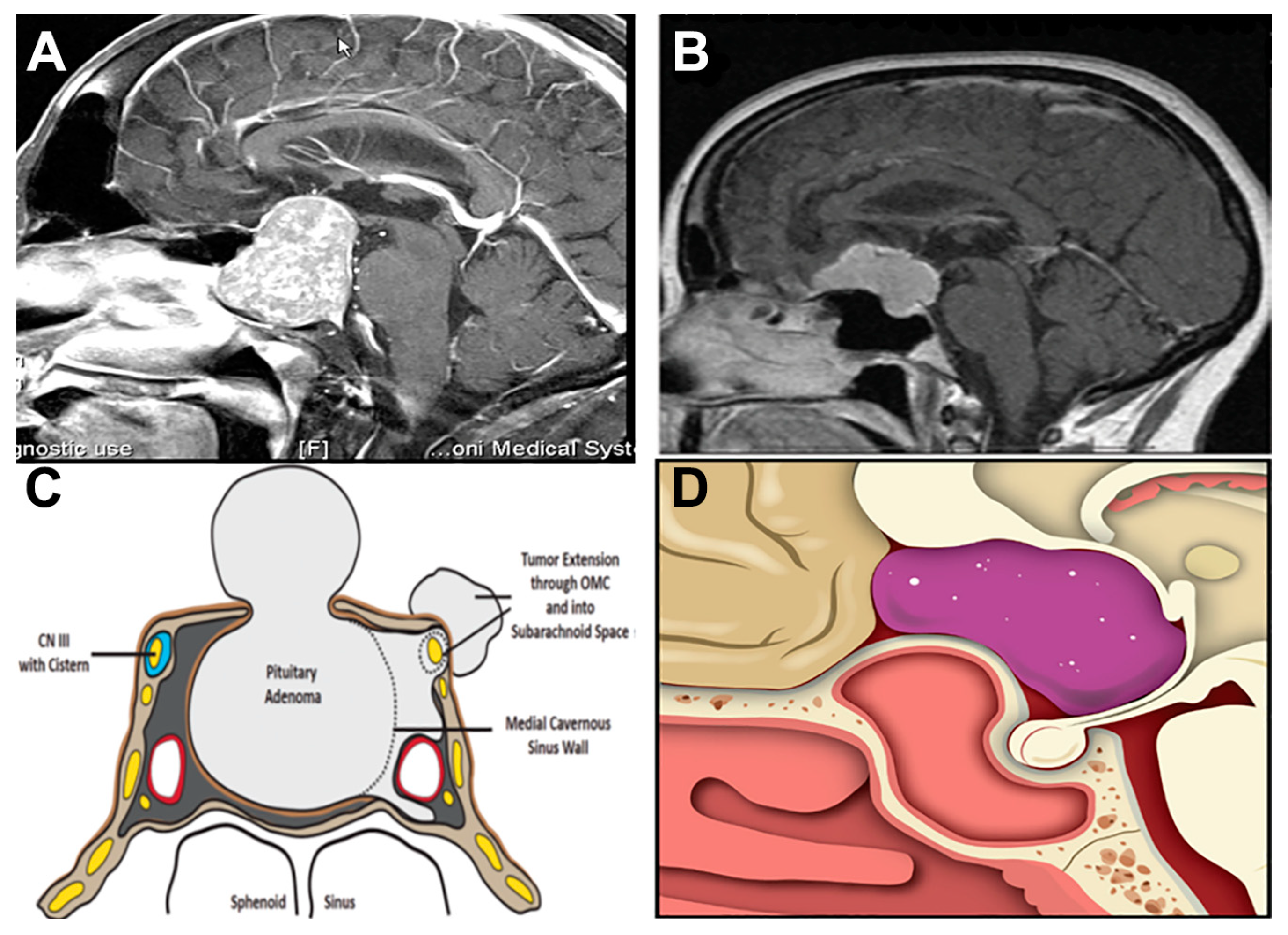 History, Current Techniques, and Future Prospects of Surgery