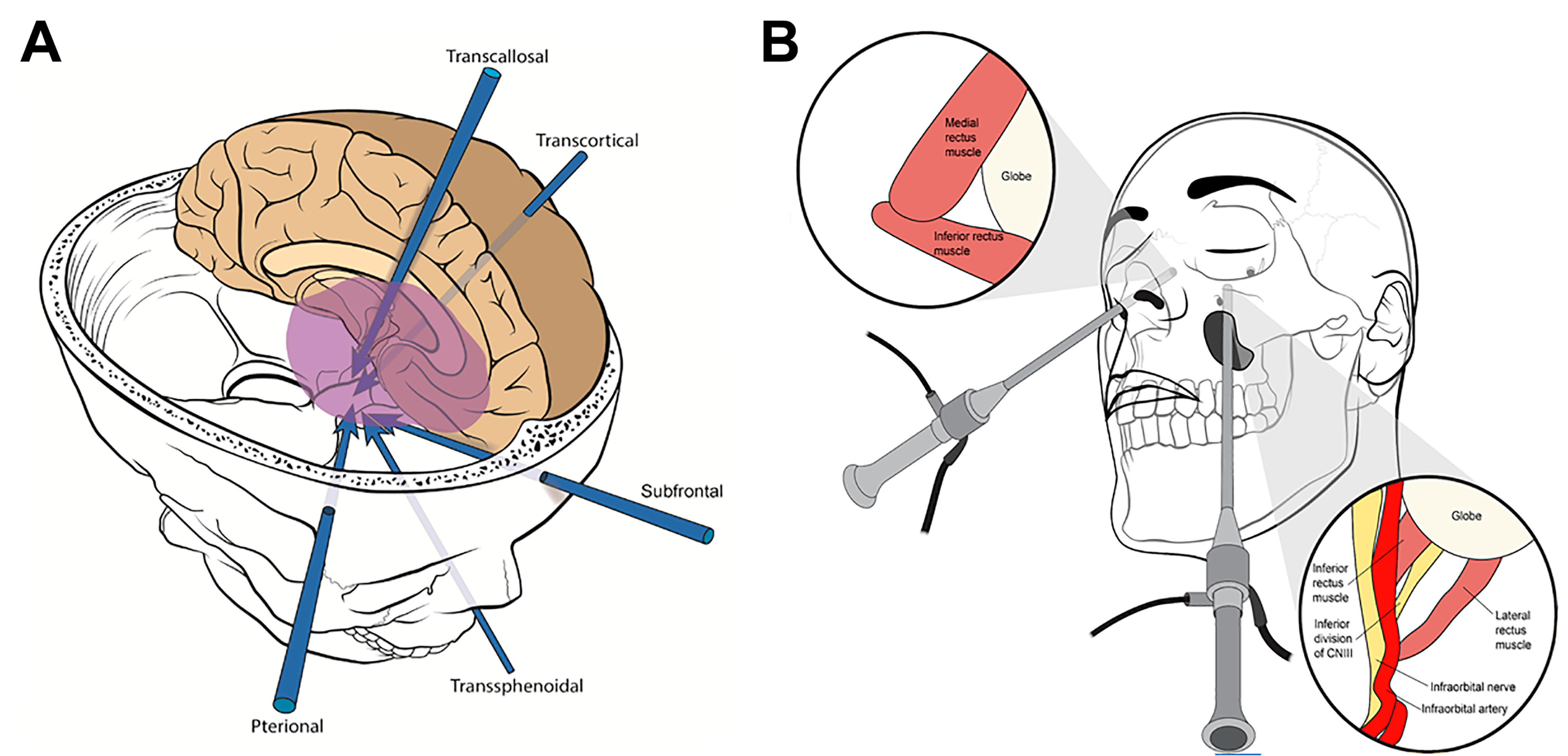 Cancers 15 02896 g004 Cancers 15 02896 g004