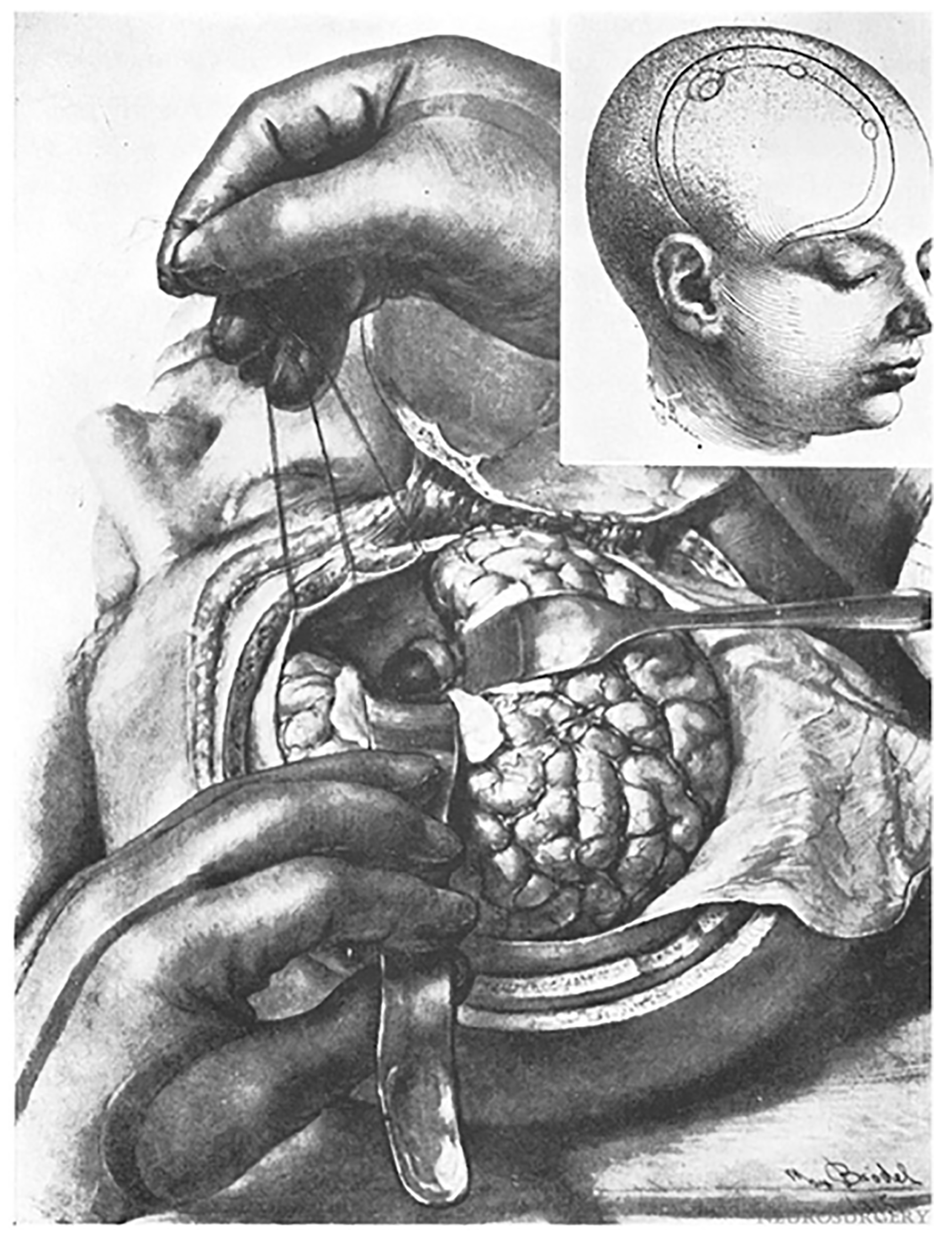 Cancers 15 02896 g006 Cancers 15 02896 g006