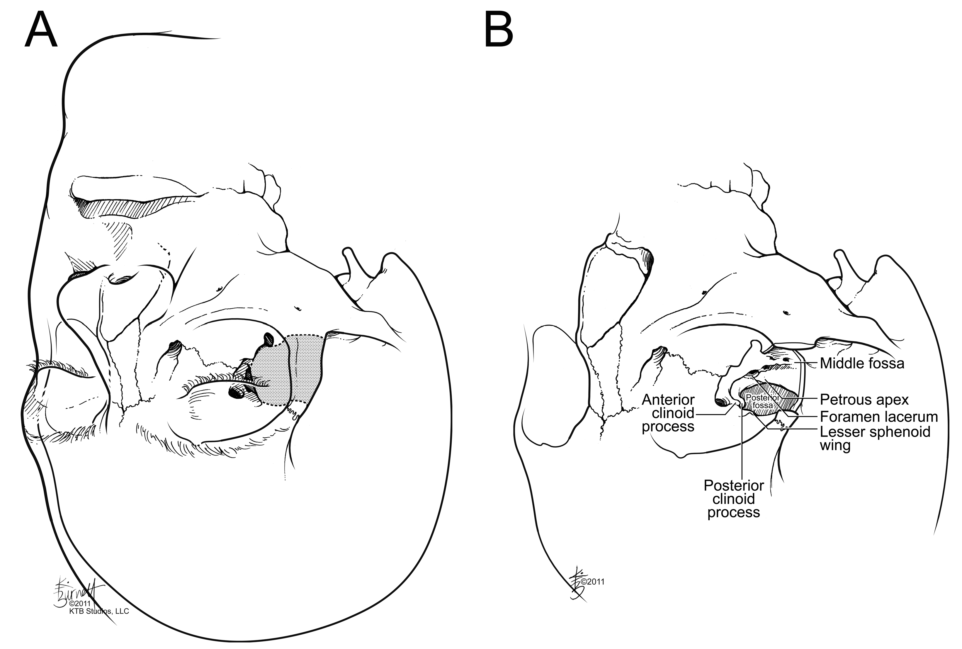 Cancers 15 02896 g007 Cancers 15 02896 g007