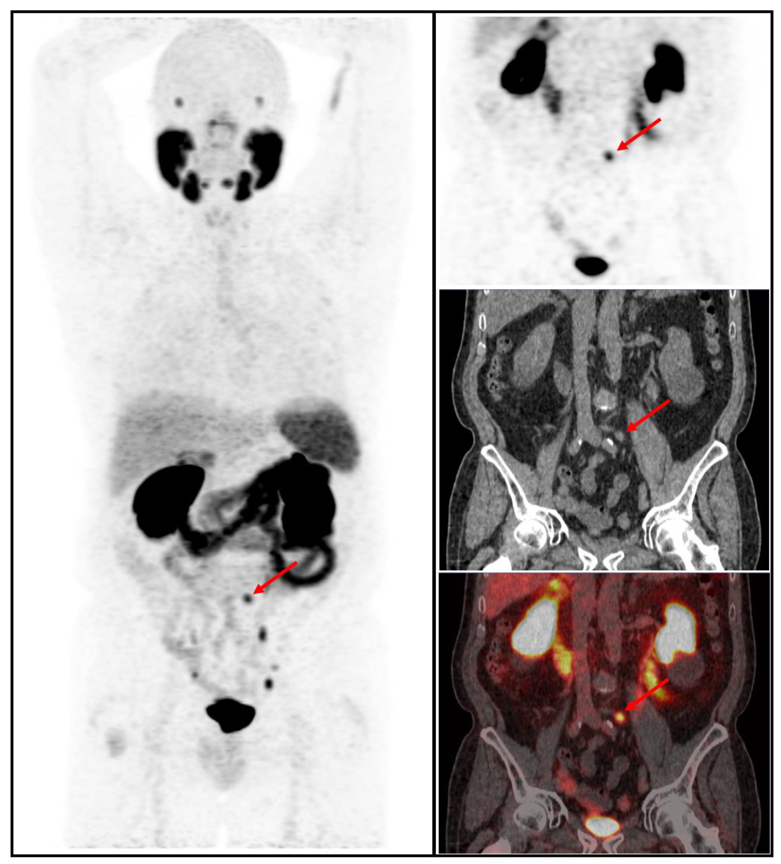 Cancers 15 02926 g003 Cancers 15 02926 g003