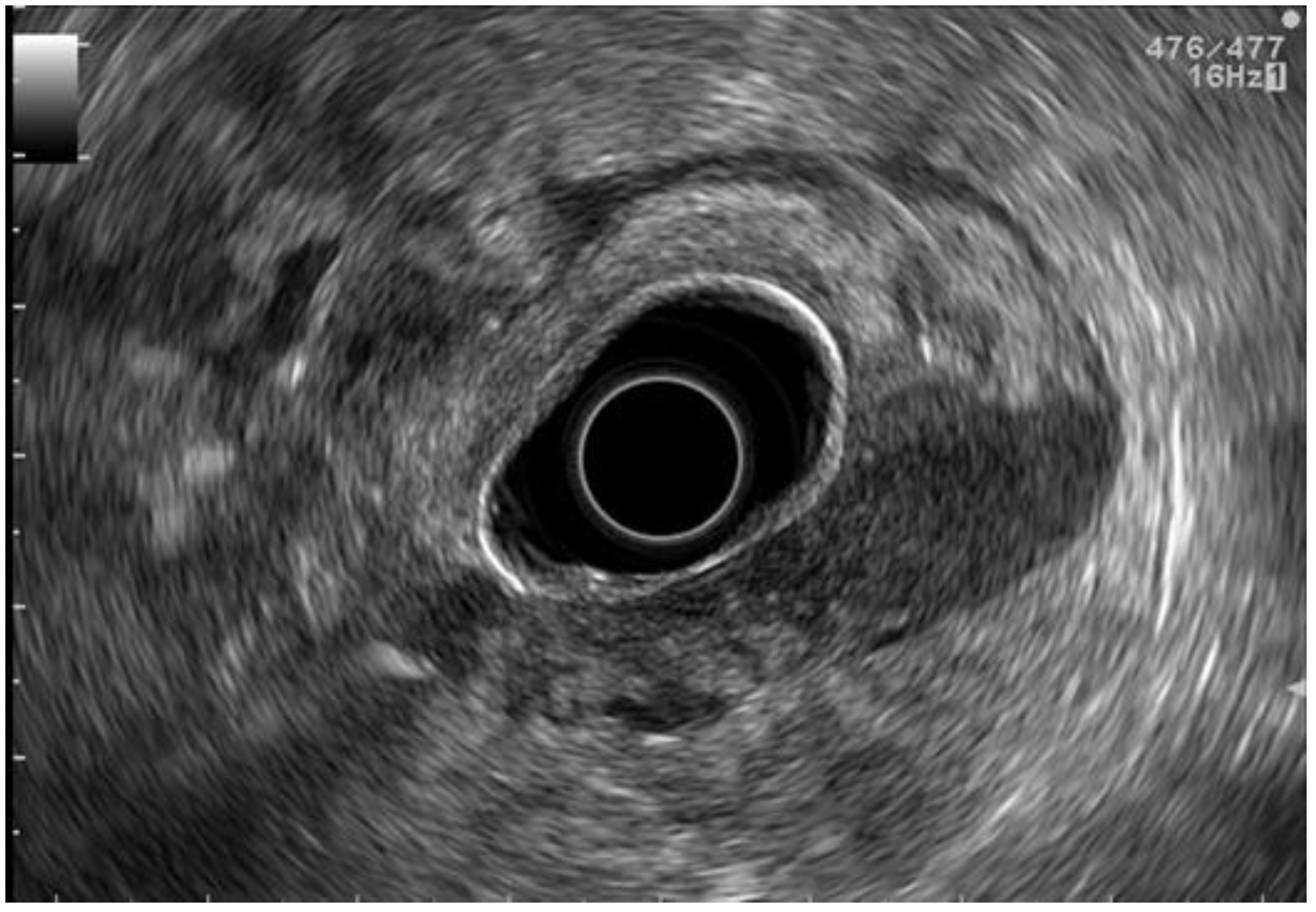 Cancers 15 02941 g001 Cancers 15 02941 g001