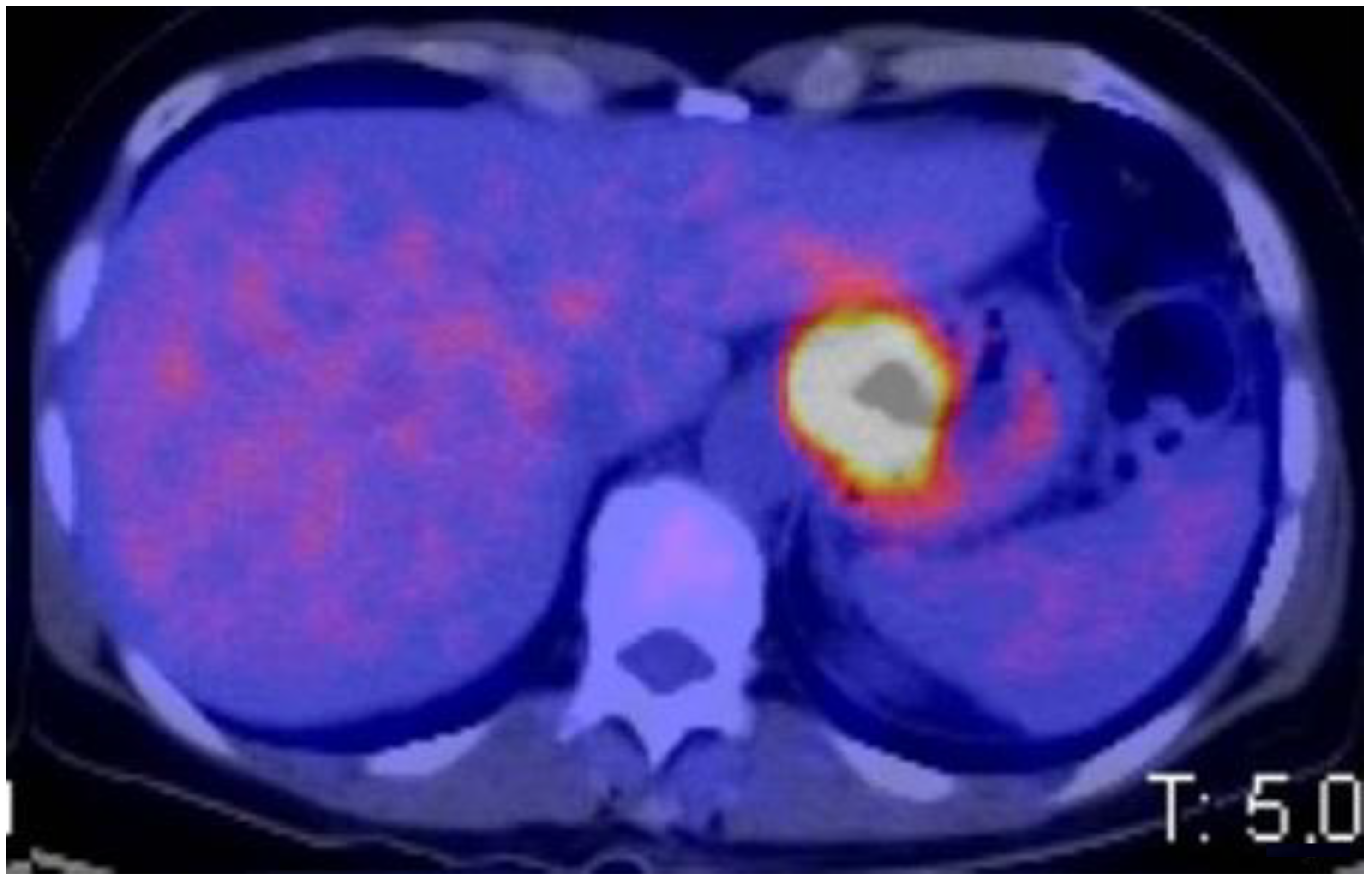 Cancers 15 02941 g002 Cancers 15 02941 g002