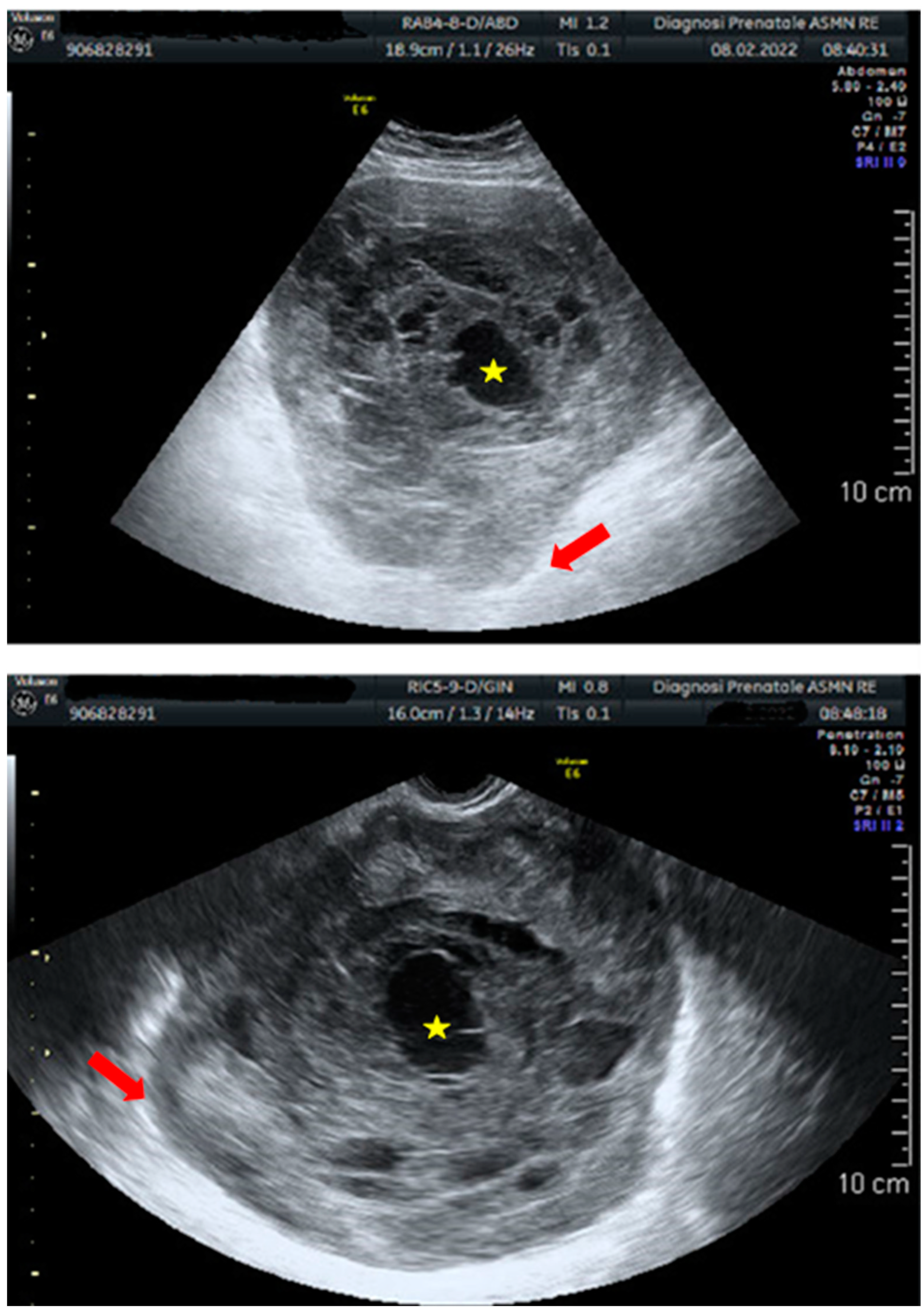 Cancers 15 02953 g006 Cancers 15 02953 g006