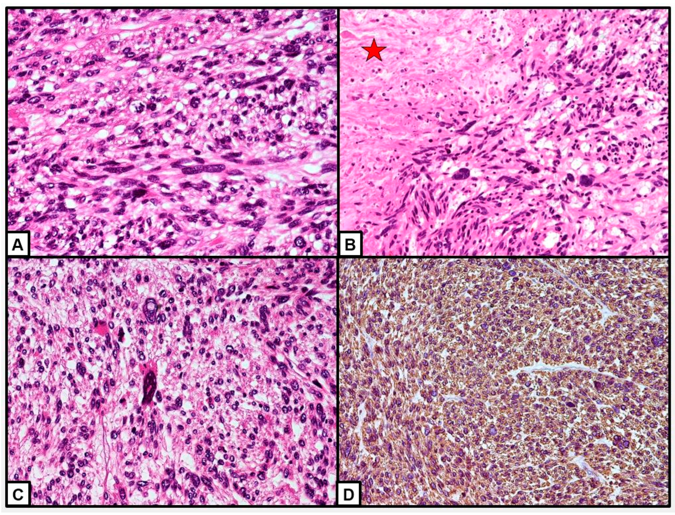 Cancers 15 02953 g009 Cancers 15 02953 g009