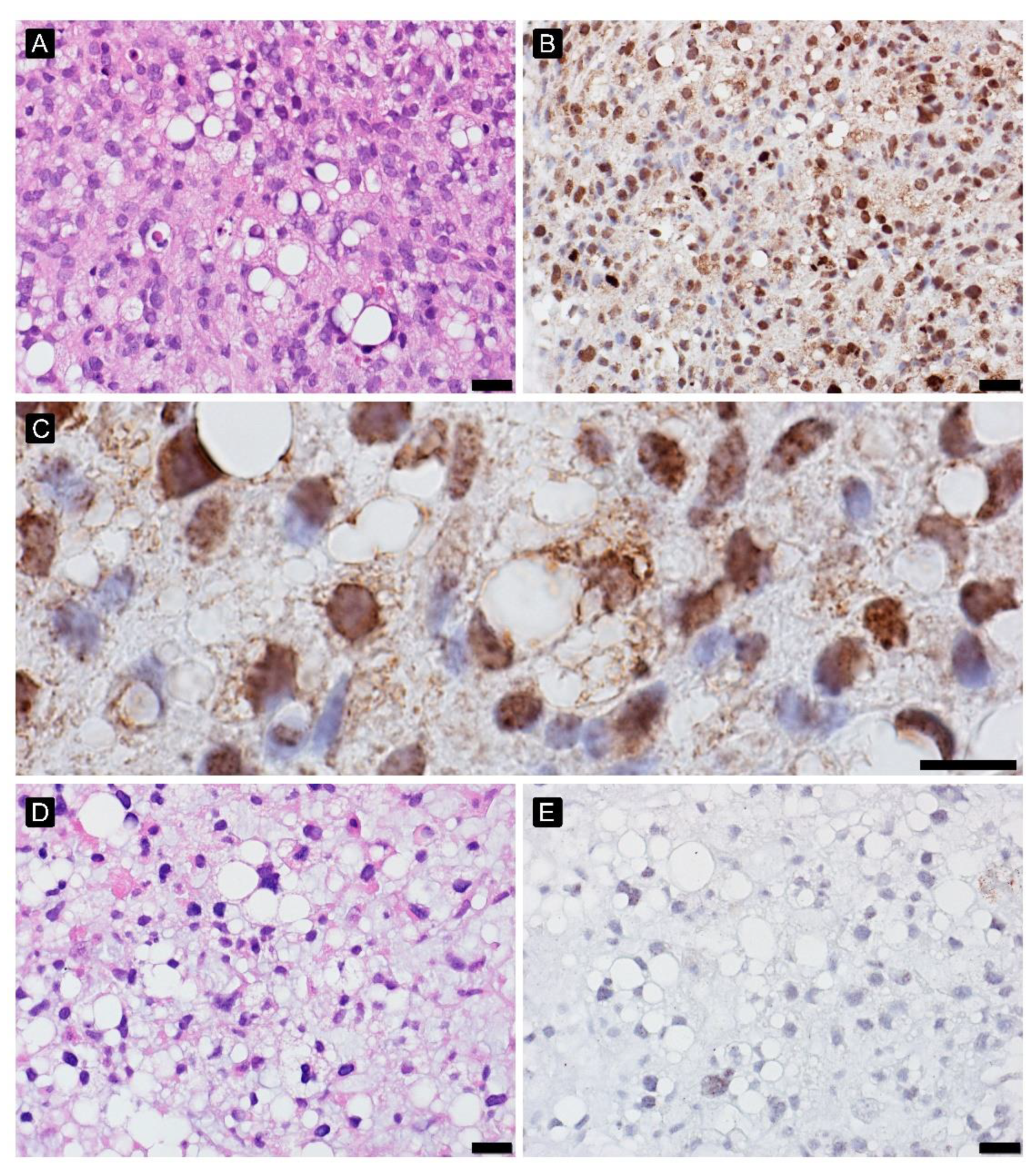 Cancers 15 02960 g003