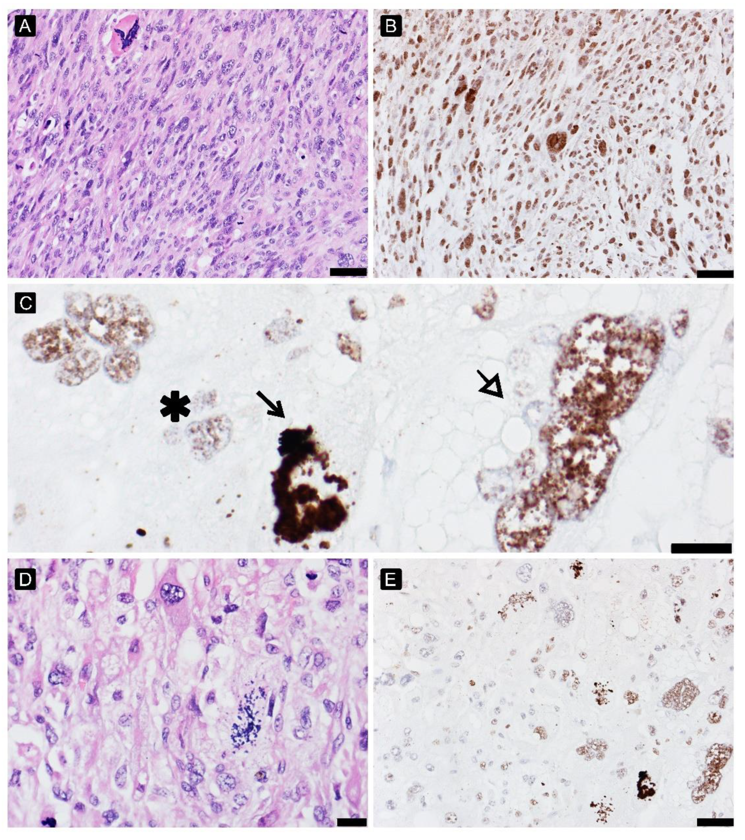 Cancers 15 02960 g004