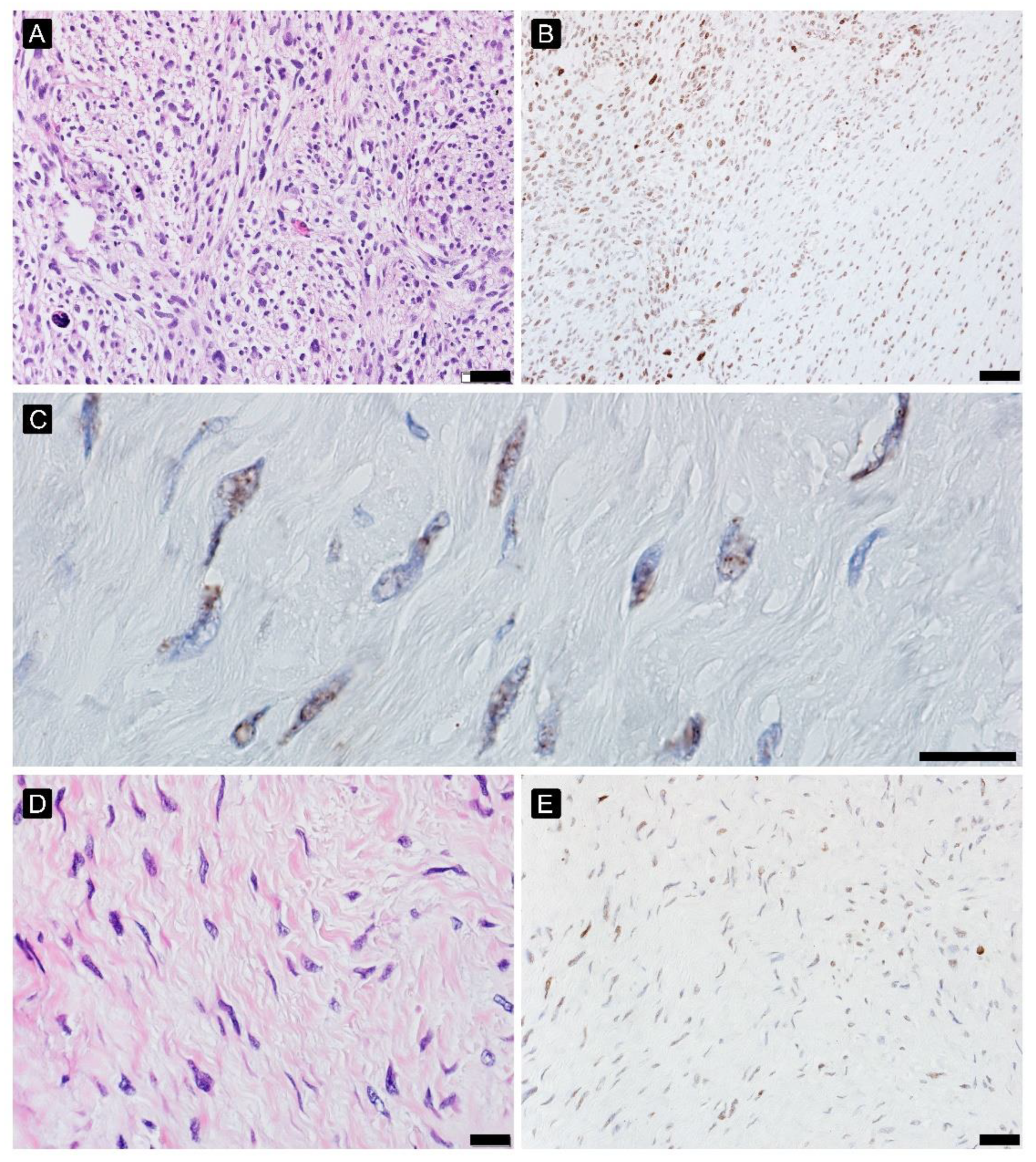 Cancers 15 02960 g005