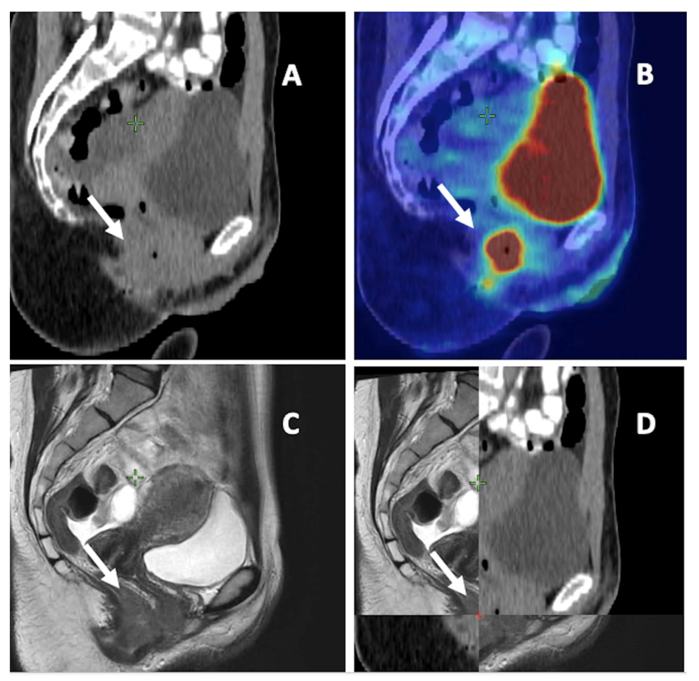 Cancers 15 02967 g002