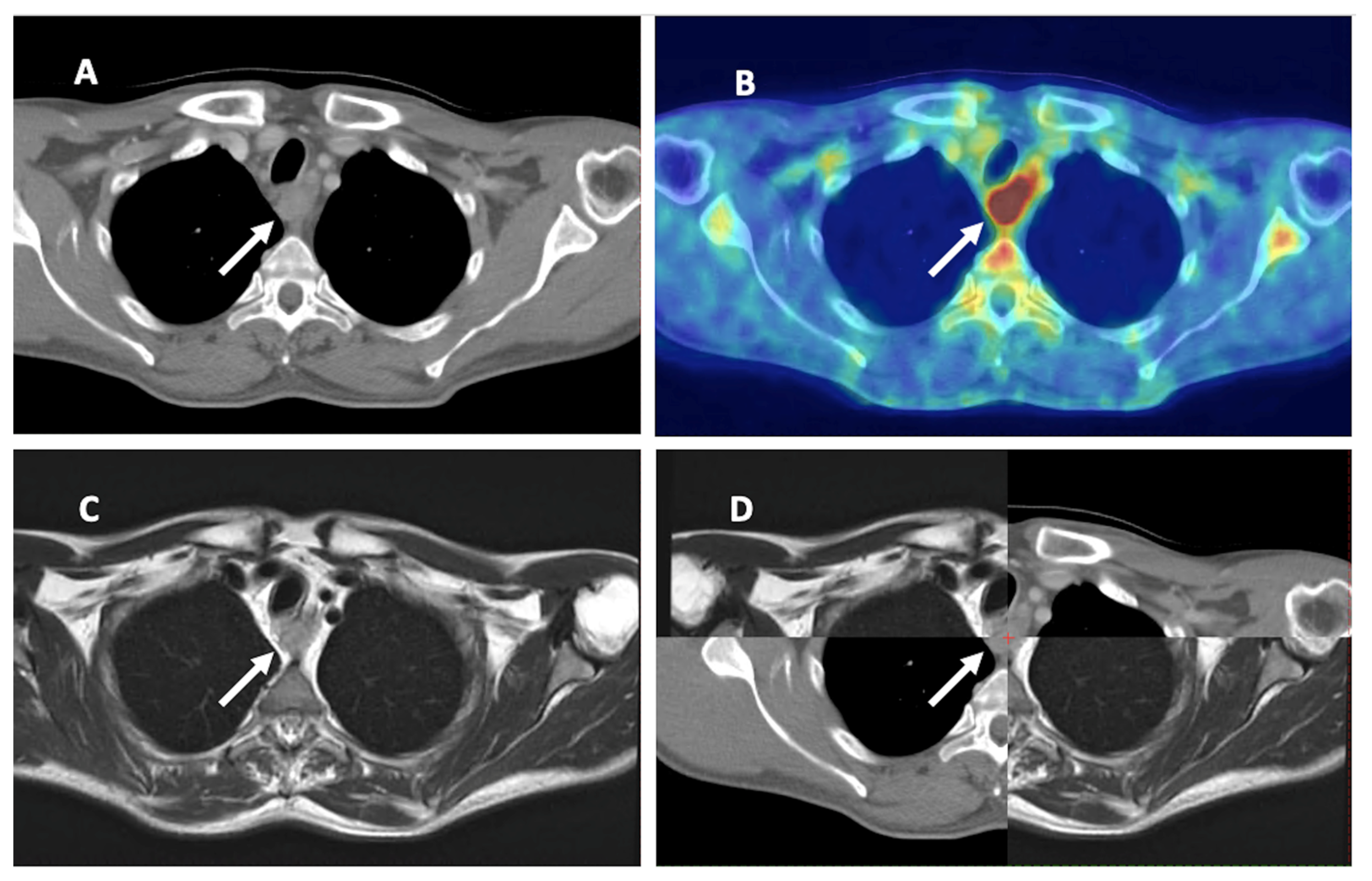 Cancers 15 02967 g003