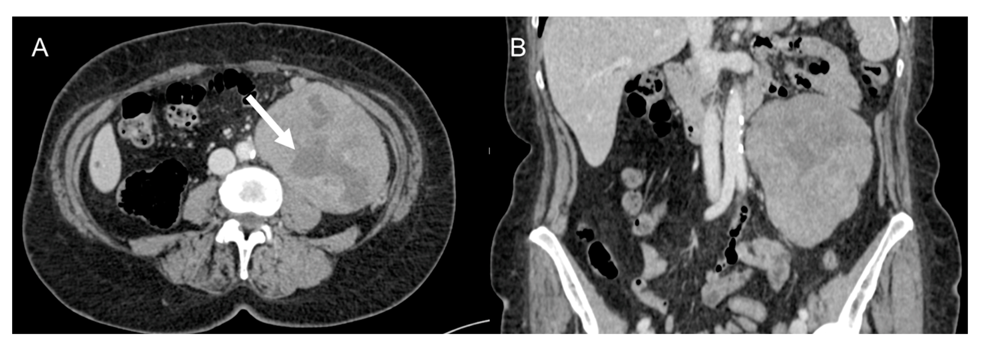 Cancers 15 02985 g004