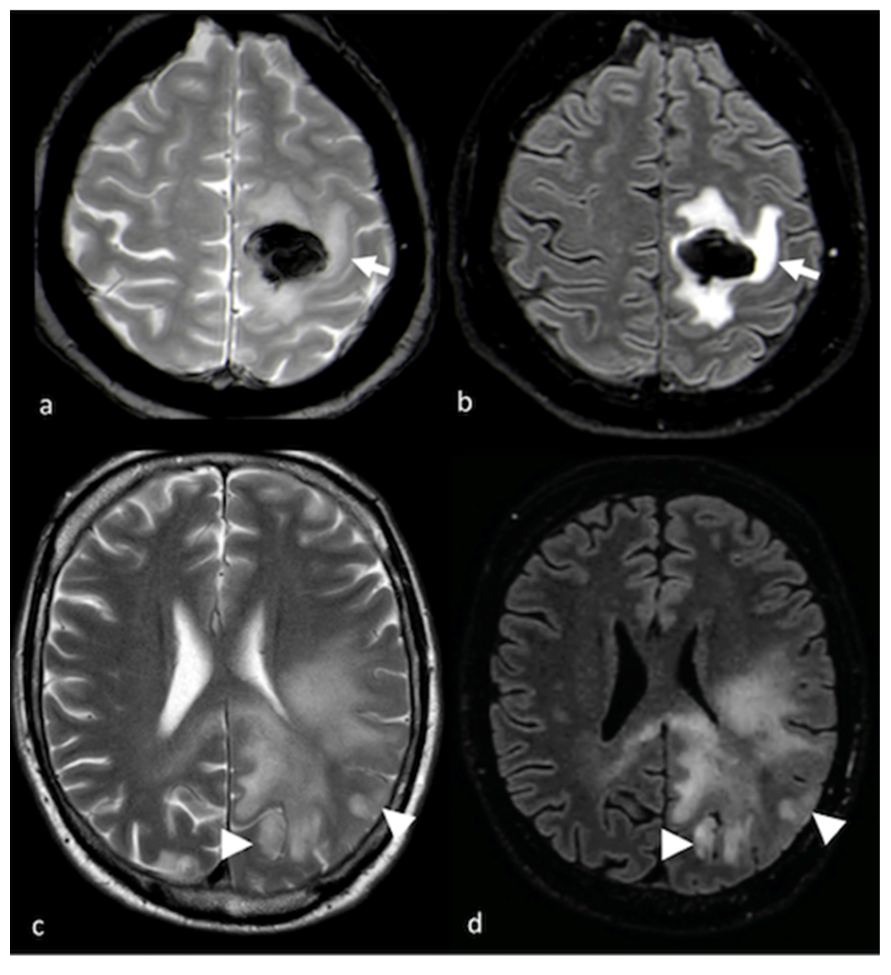 Cancers 15 02992 g001