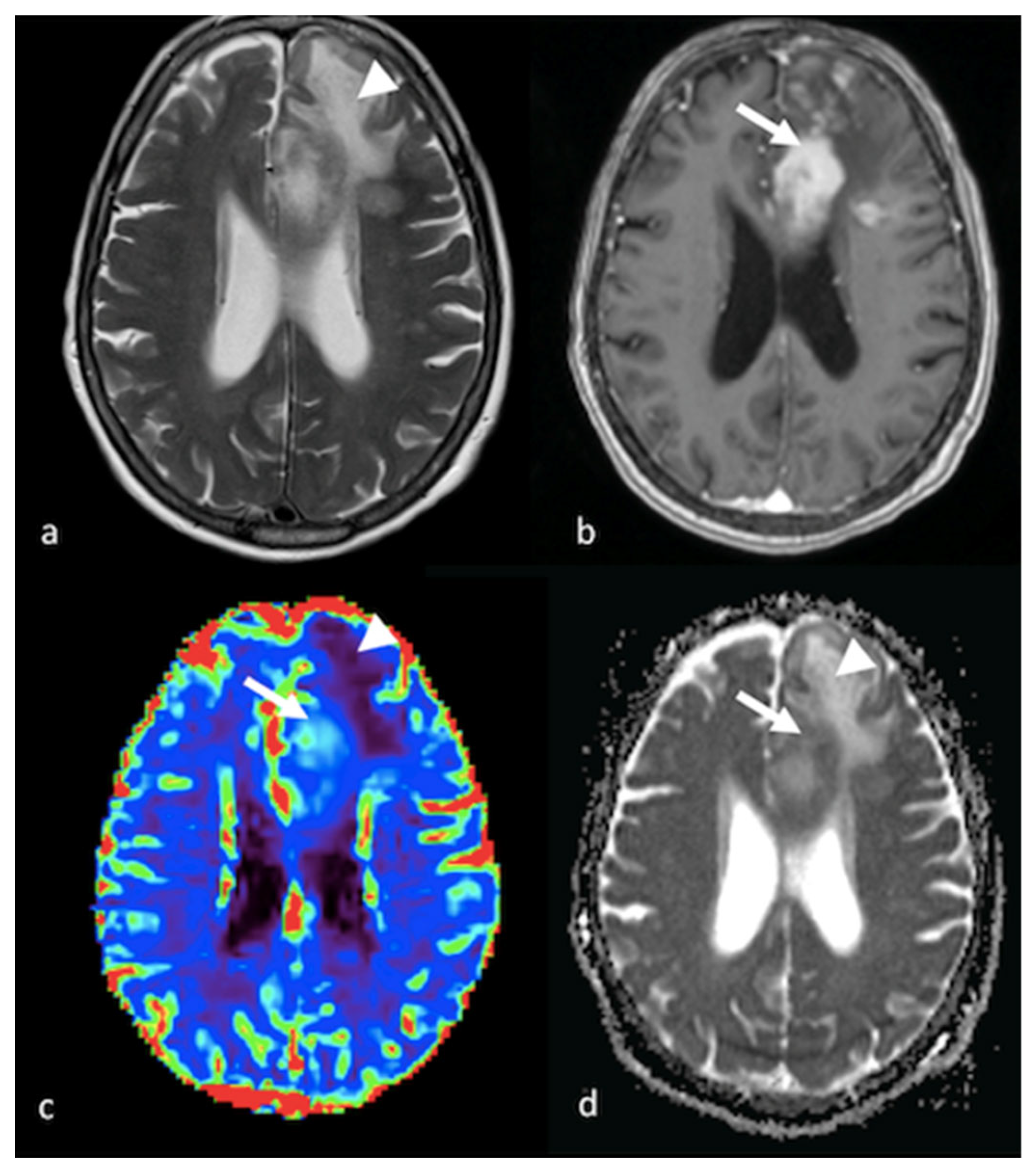 Cancers 15 02992 g002