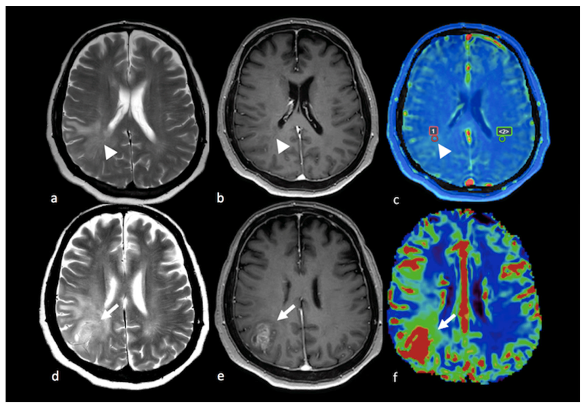 Cancers 15 02992 g008