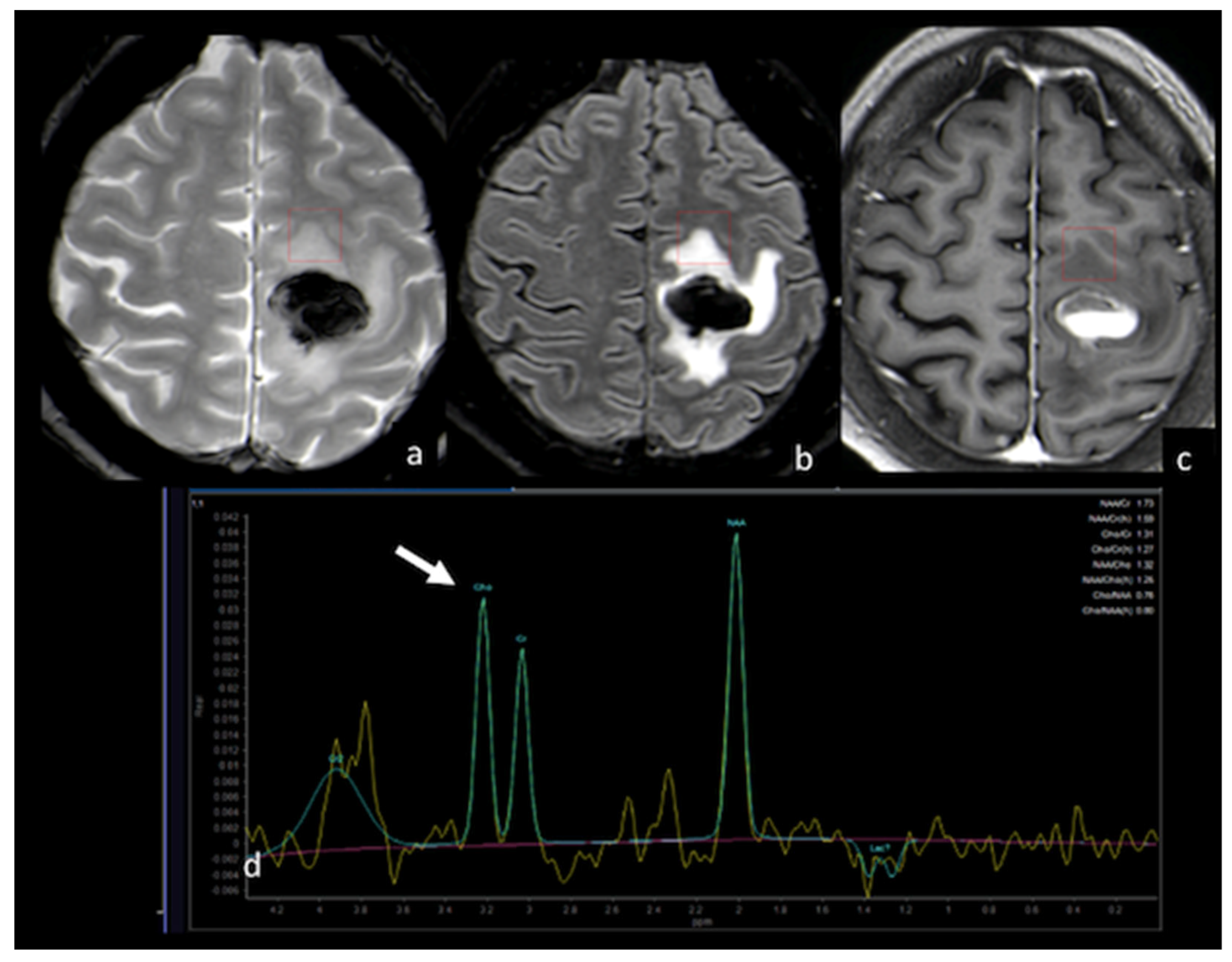 Cancers 15 02992 g011