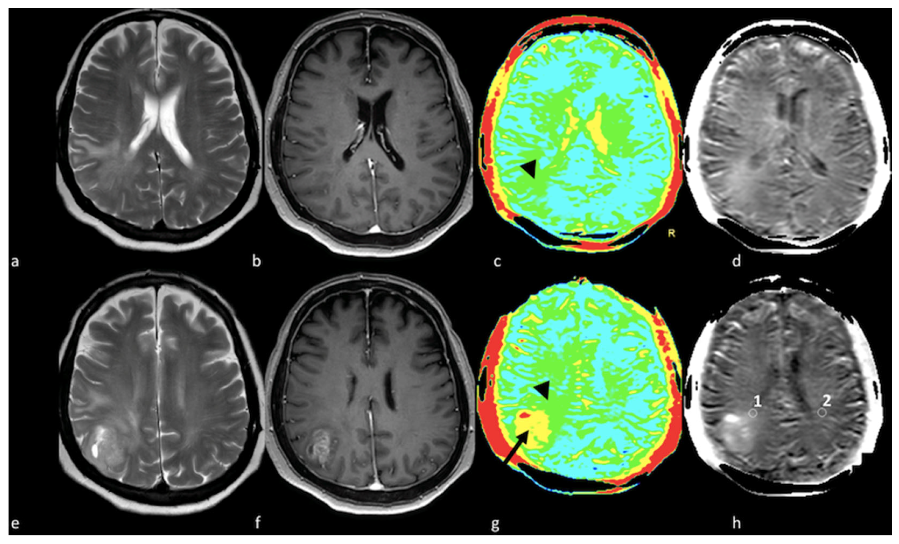 Cancers 15 02992 g012