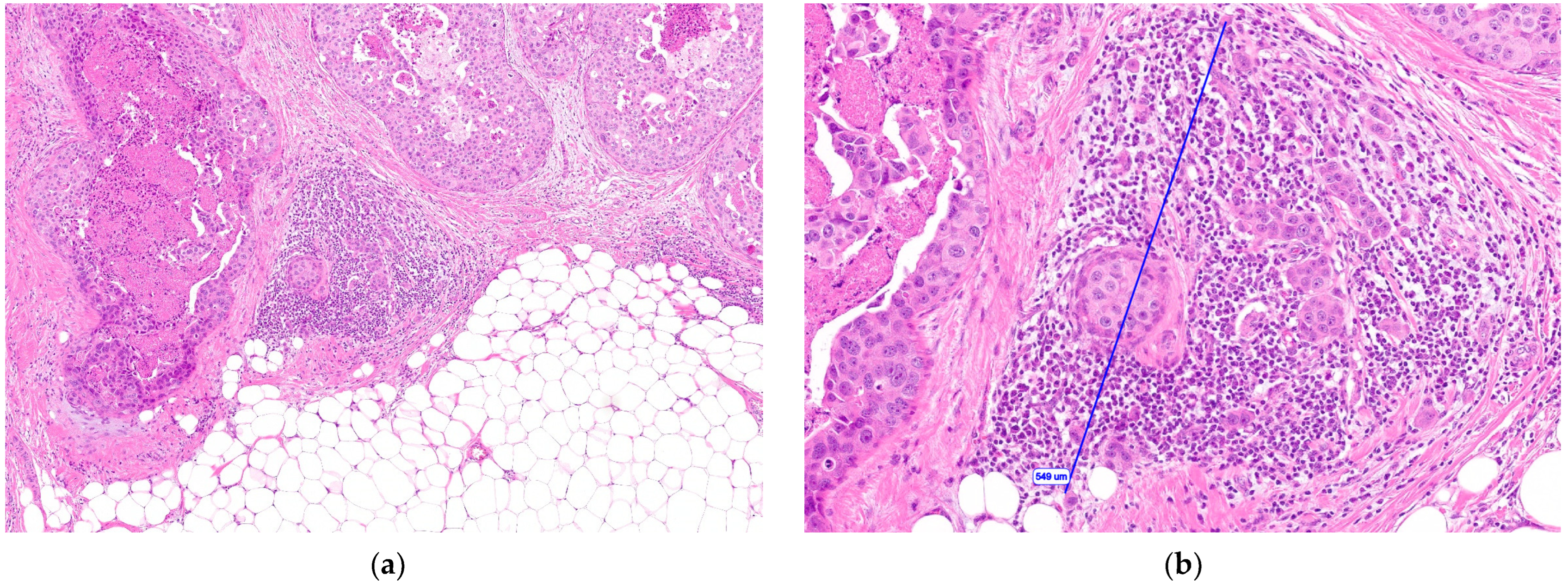 Cancers 15 03007 g001 Cancers 15 03007 g001