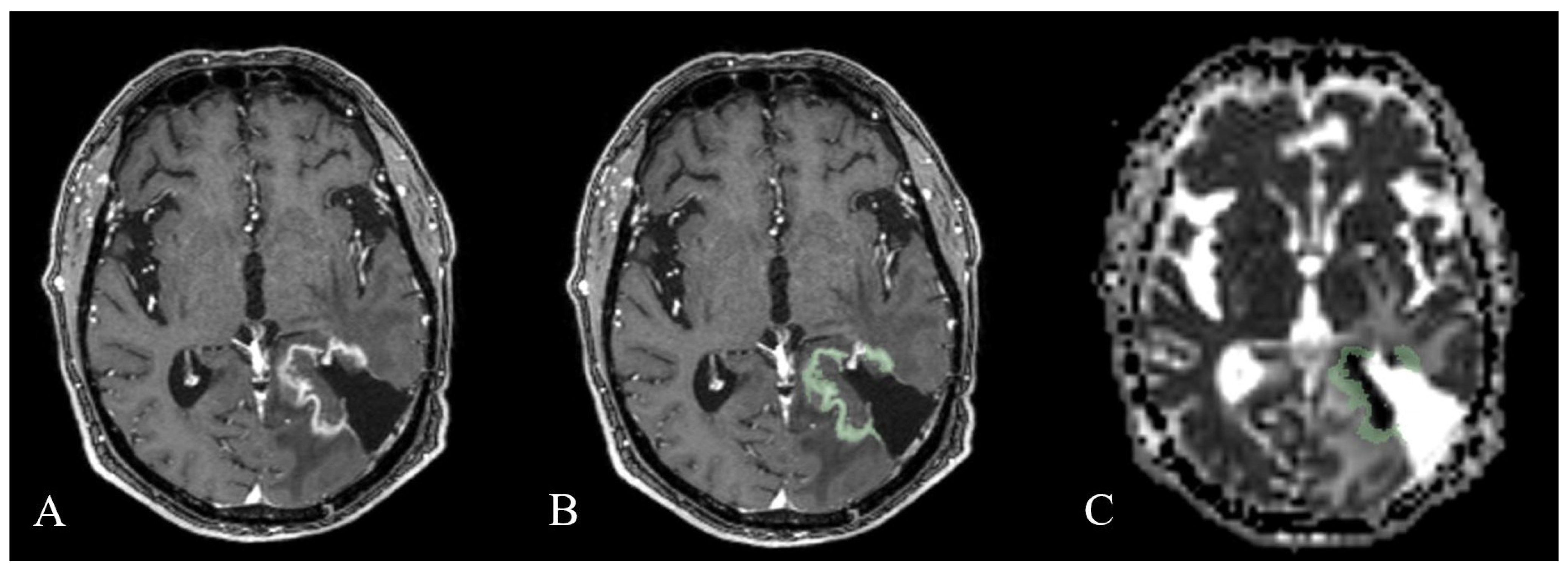 Cancers 15 03026 g001