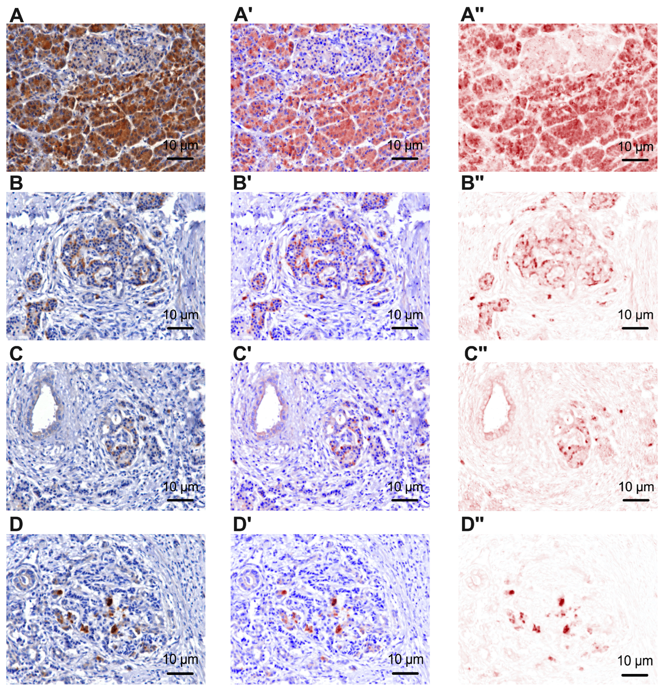 Cancers 15 03040 g002 Cancers 15 03040 g002