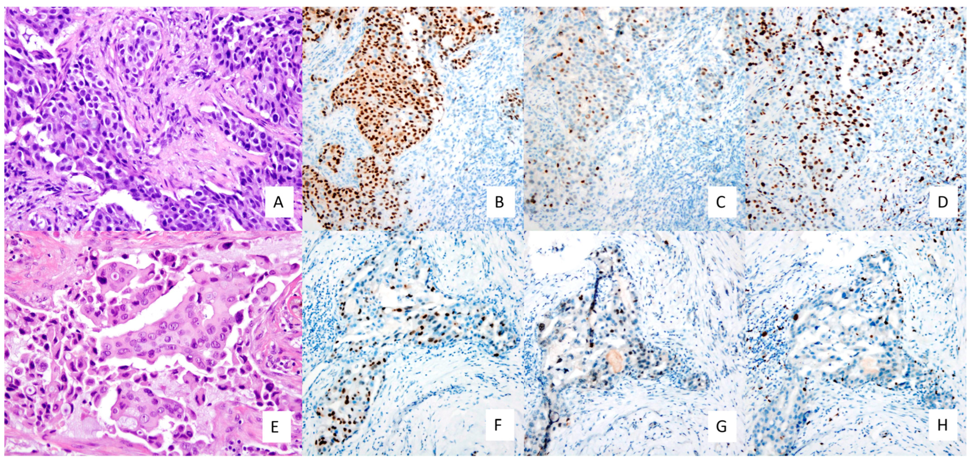 Cancers 15 03068 g007 Cancers 15 03068 g007