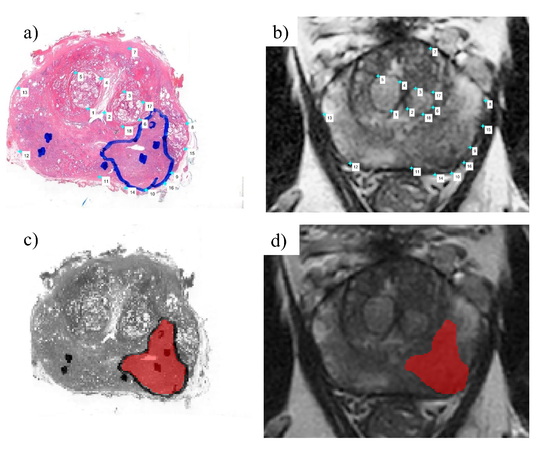 Cancers 15 03074 g002 Cancers 15 03074 g002