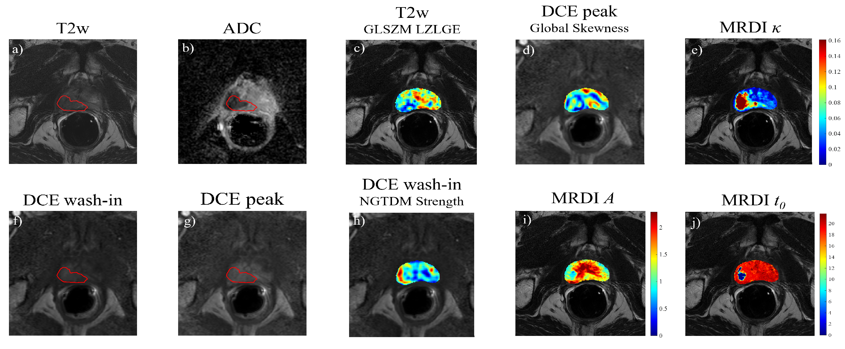 Cancers 15 03074 g004 Cancers 15 03074 g004