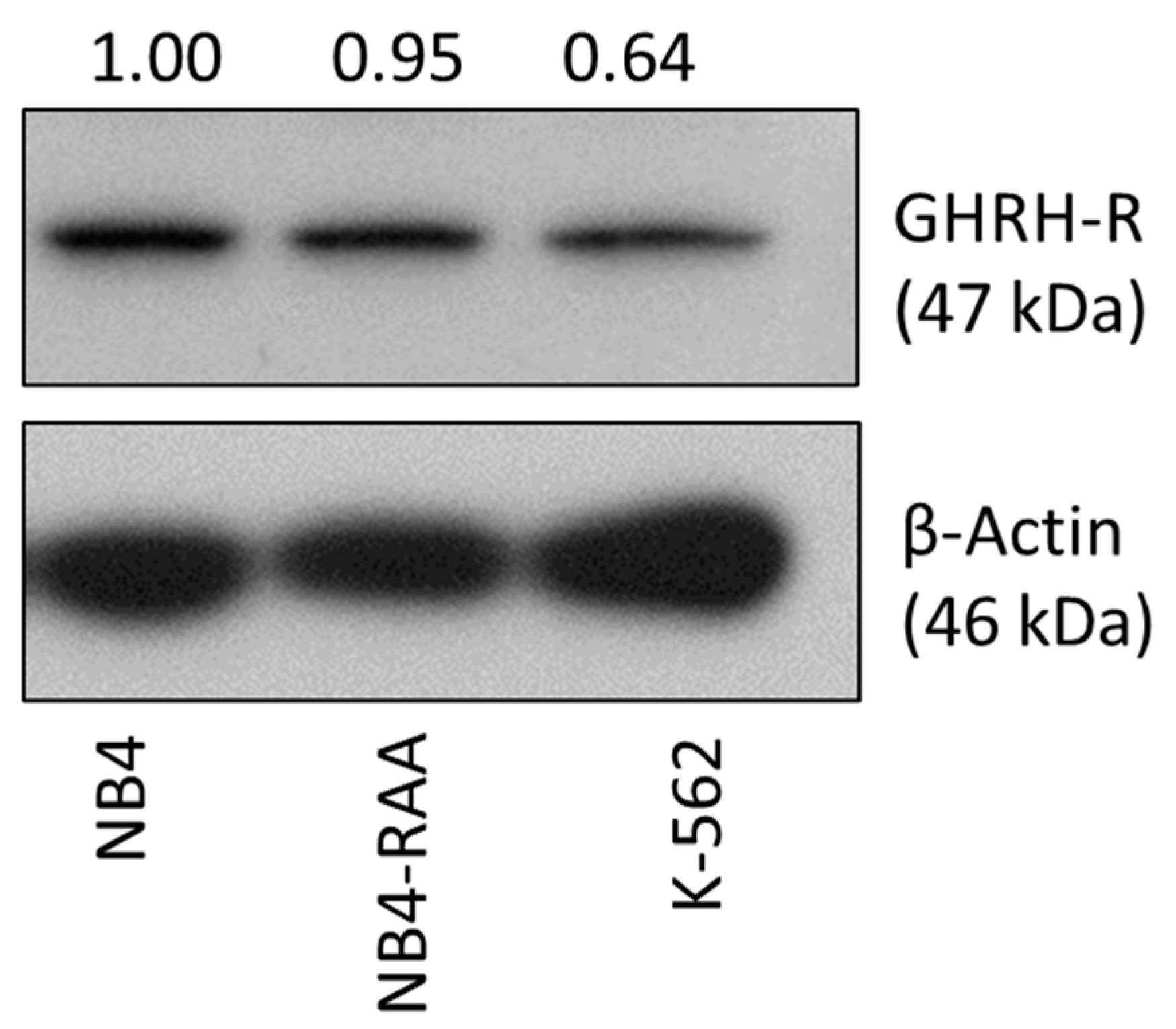 Cancers 15 03104 g001 Cancers 15 03104 g001