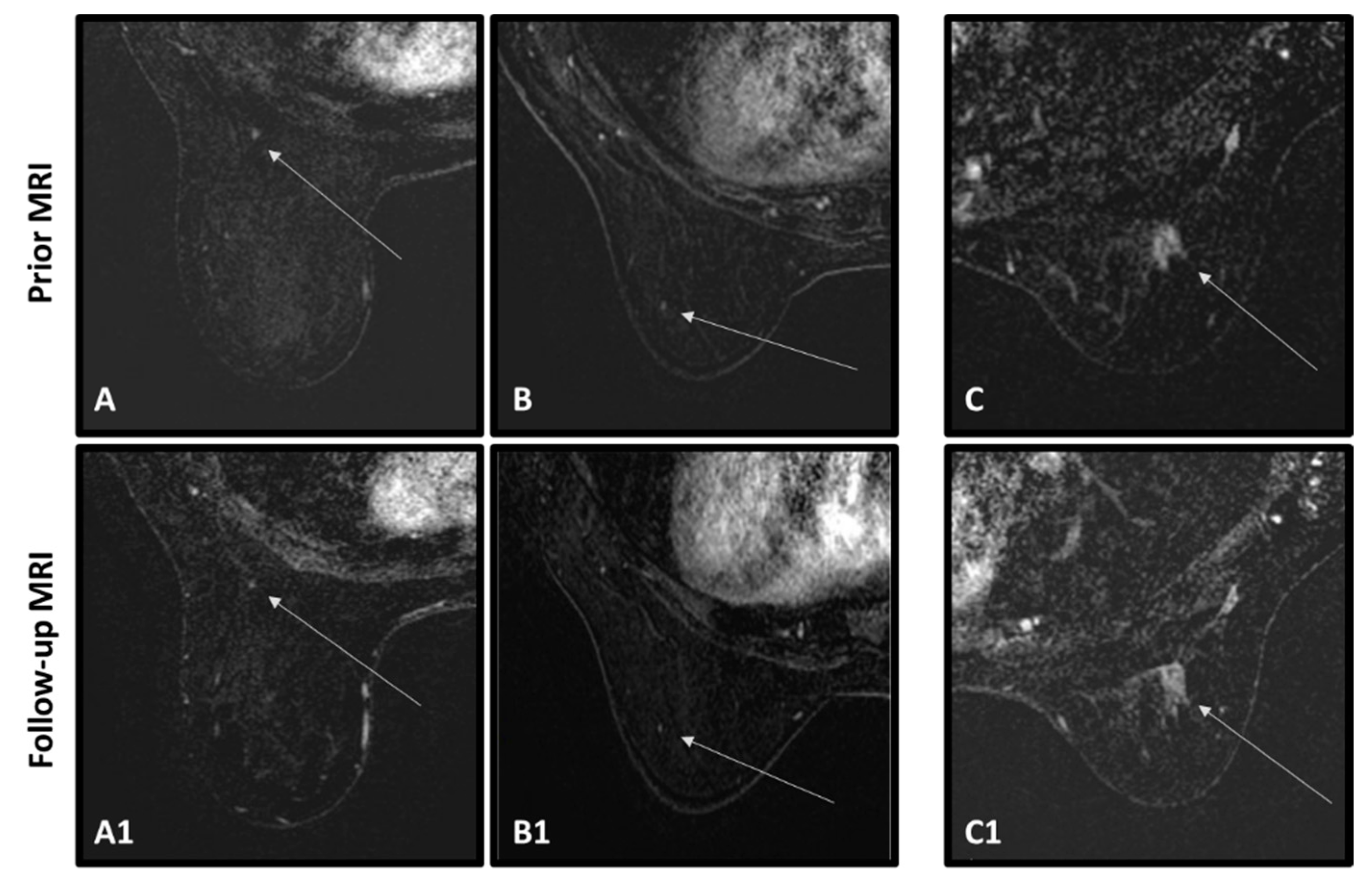 Cancers 15 03120 g006 Cancers 15 03120 g006