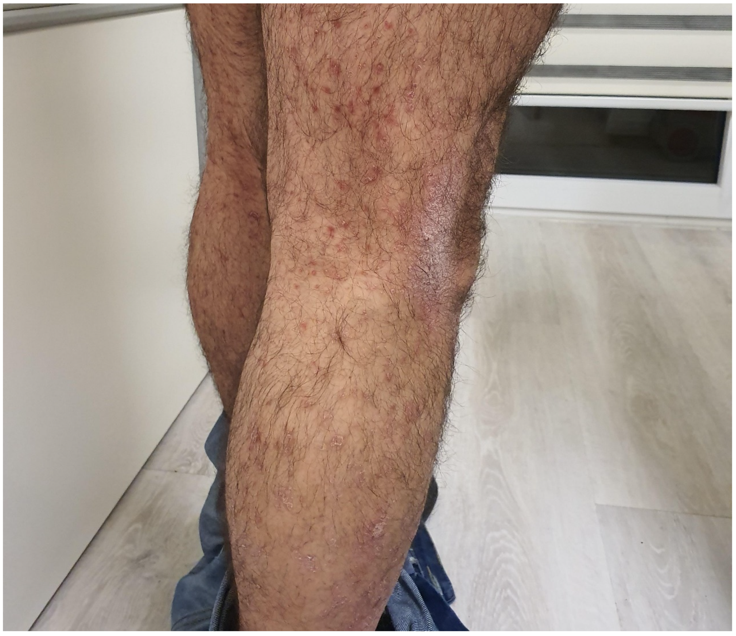 Cancers 15 03126 g003 Cancers 15 03126 g003