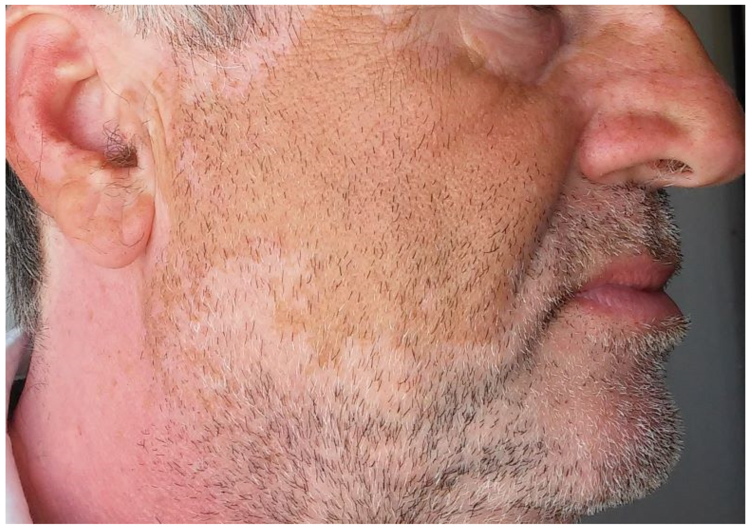 Cancers 15 03126 g004 Cancers 15 03126 g004