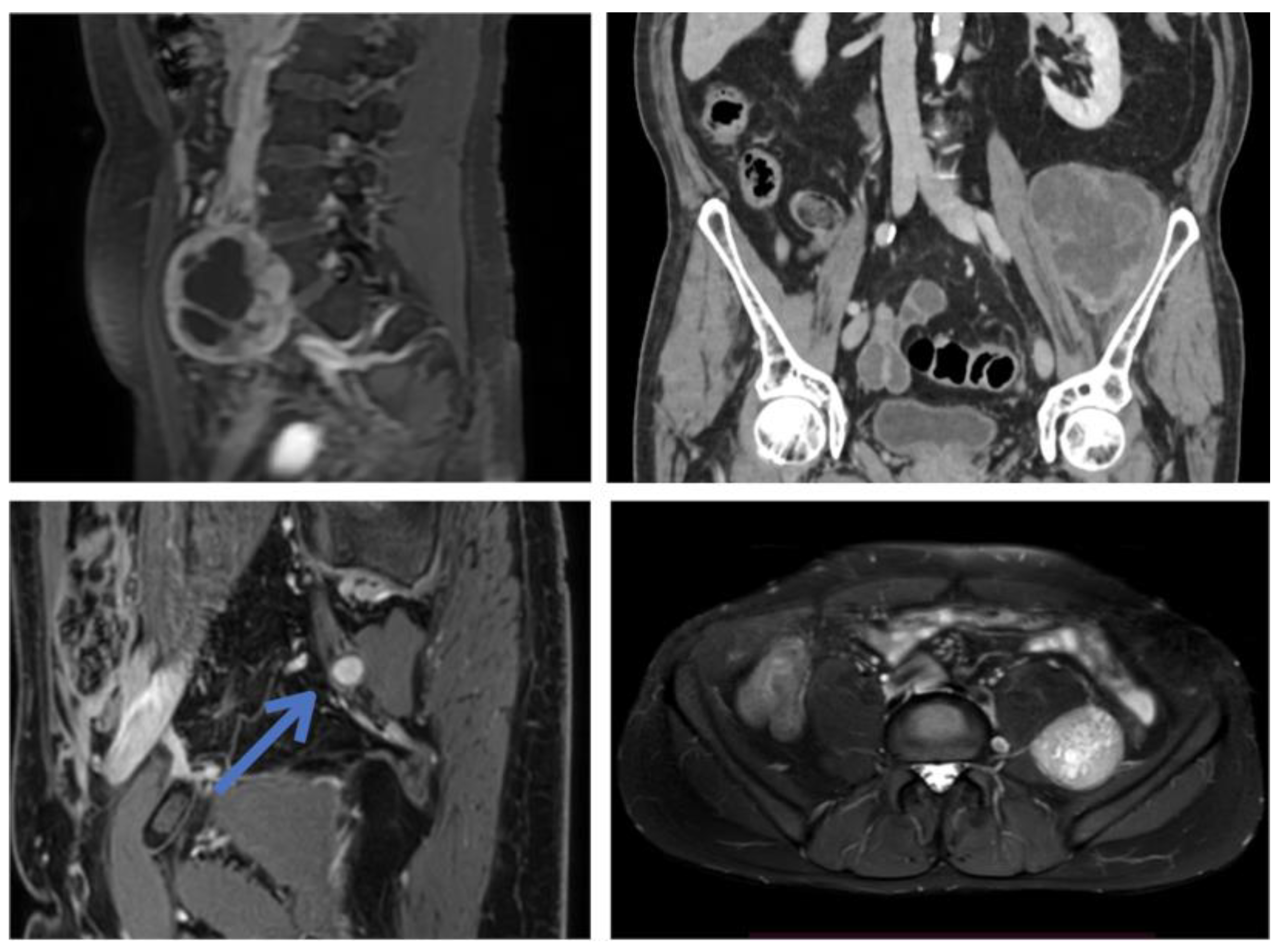 Cancers 15 03138 g001 Cancers 15 03138 g001