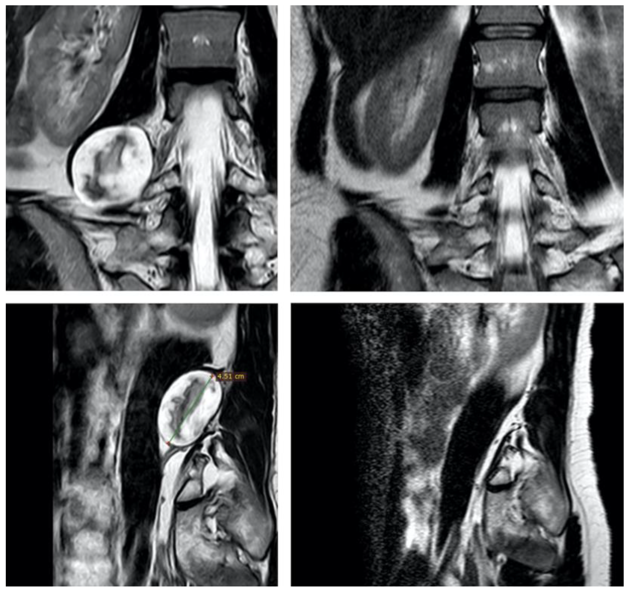 Cancers 15 03138 g002 Cancers 15 03138 g002