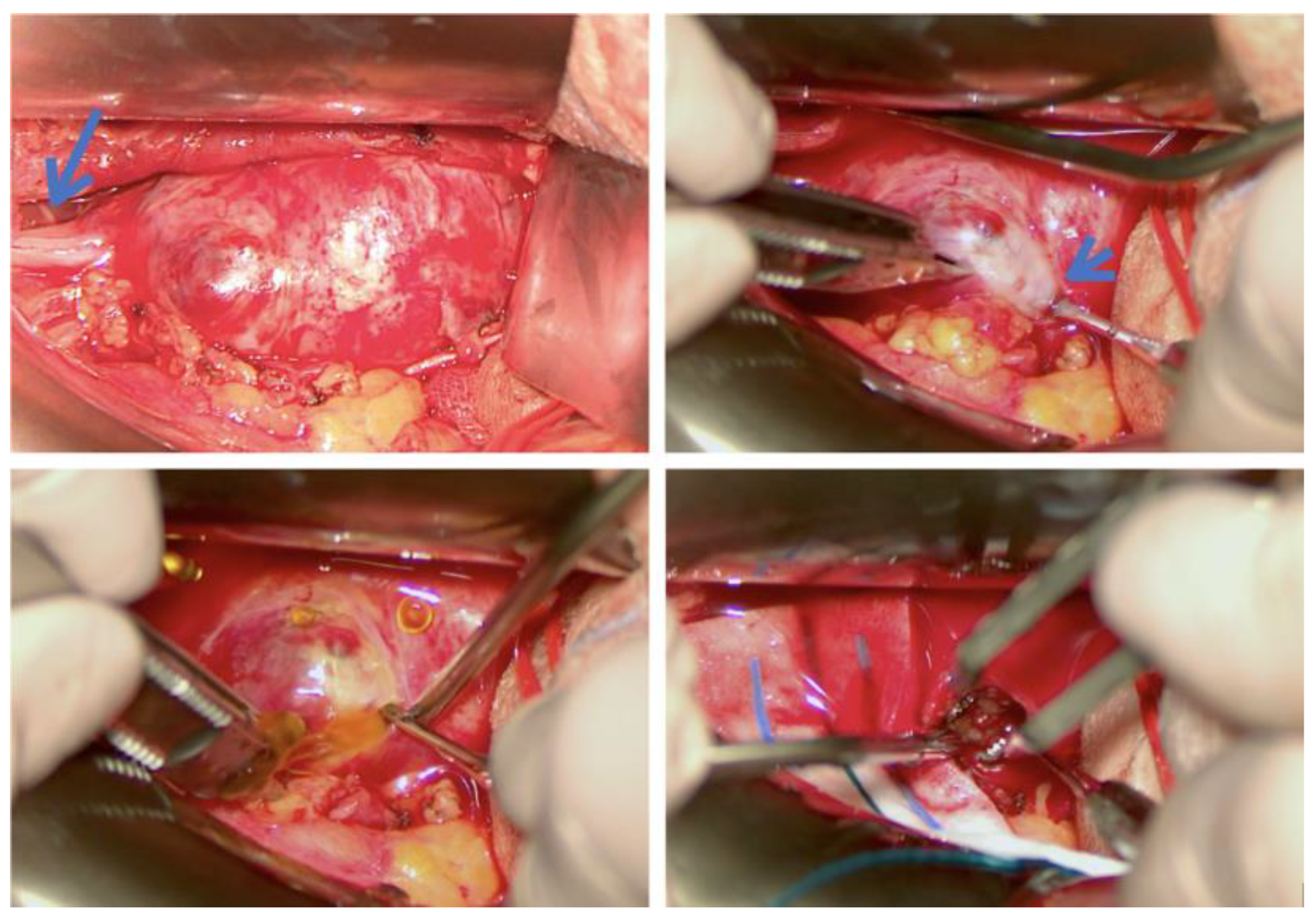 Cancers 15 03138 g003 Cancers 15 03138 g003