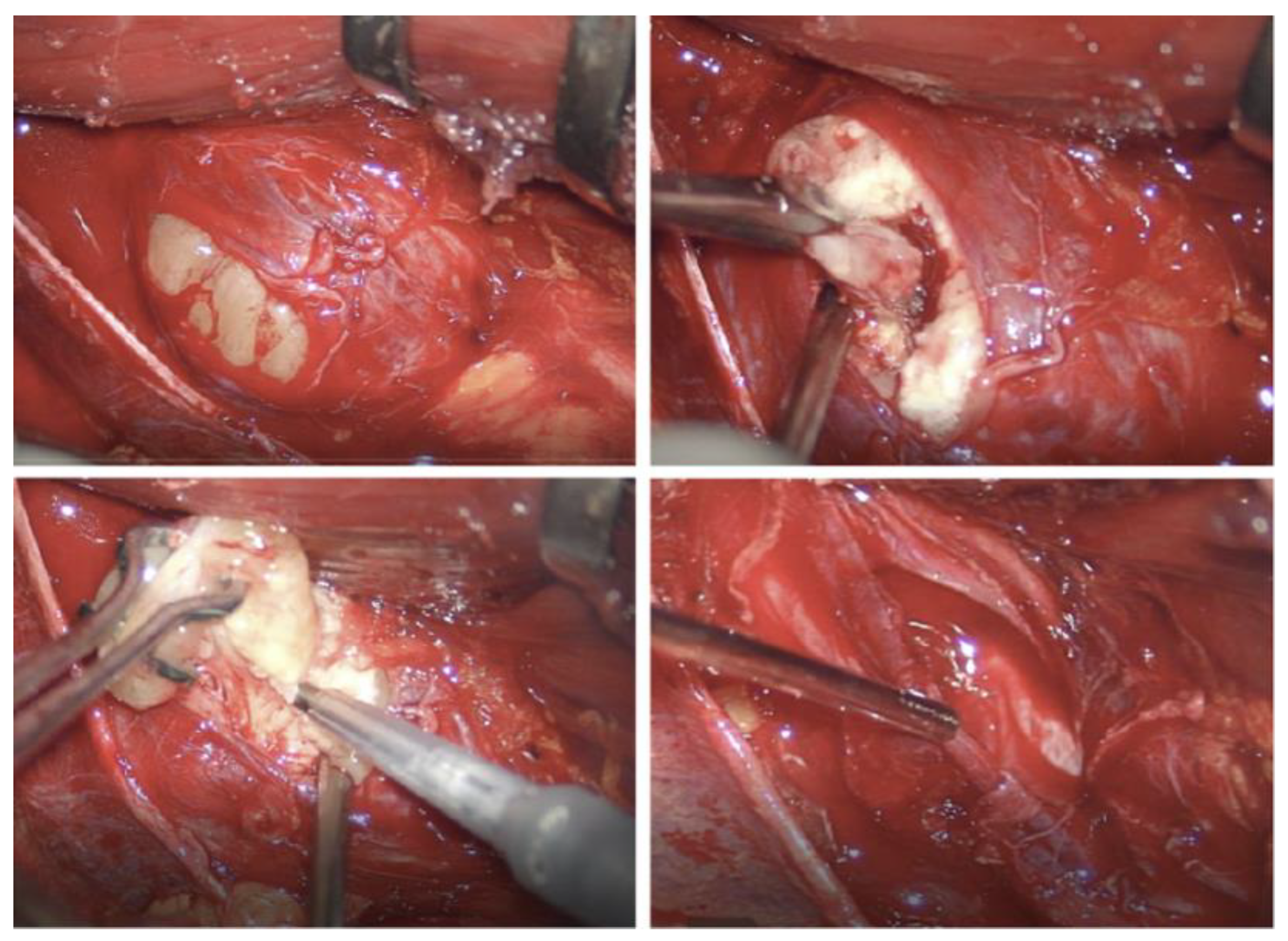 Cancers 15 03138 g004 Cancers 15 03138 g004