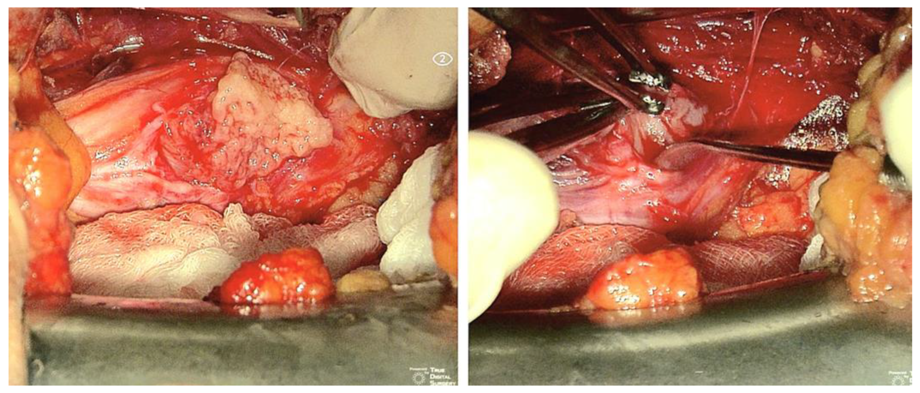 Cancers 15 03138 g005 Cancers 15 03138 g005