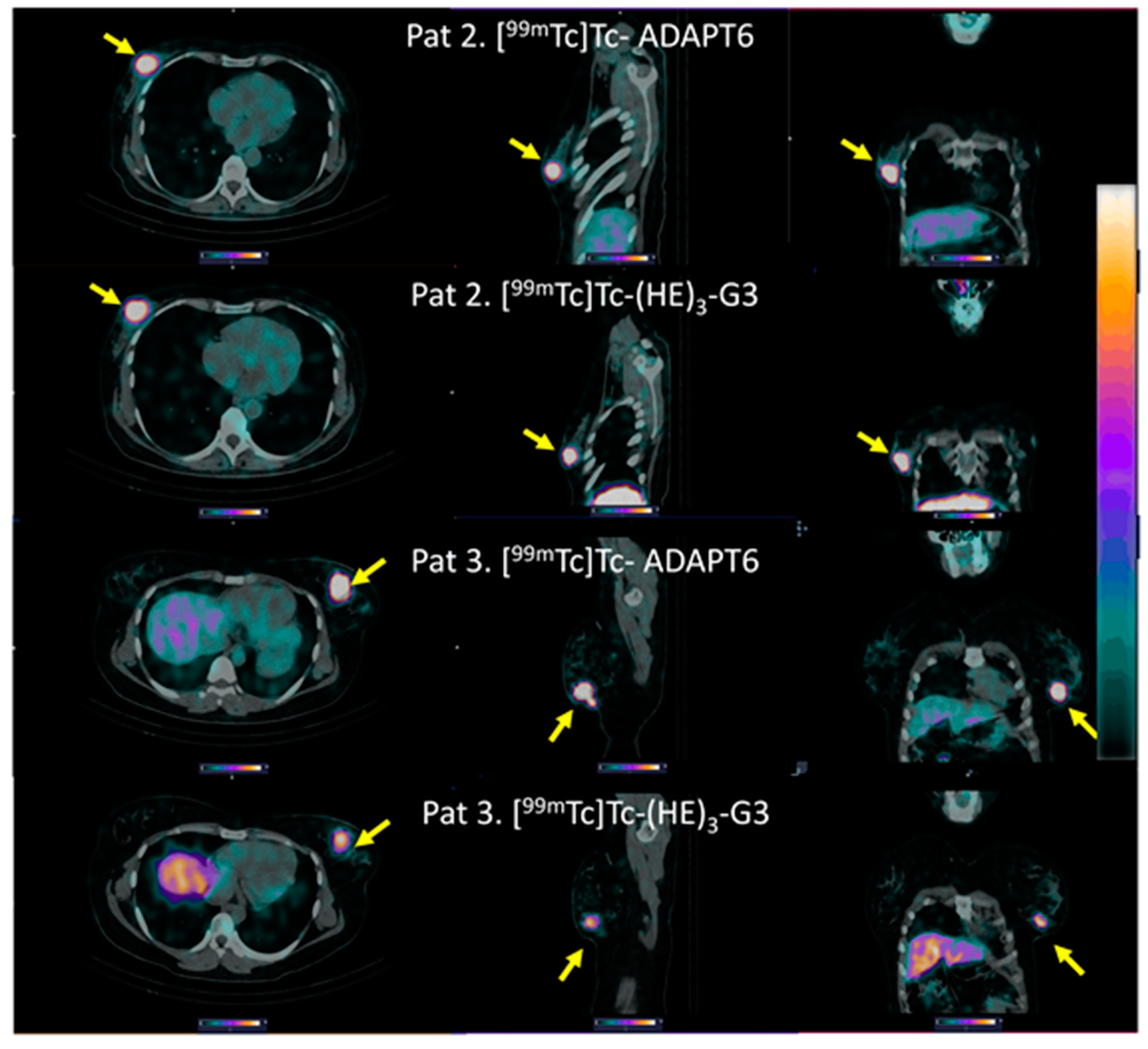 Cancers 15 03149 g005 Cancers 15 03149 g005